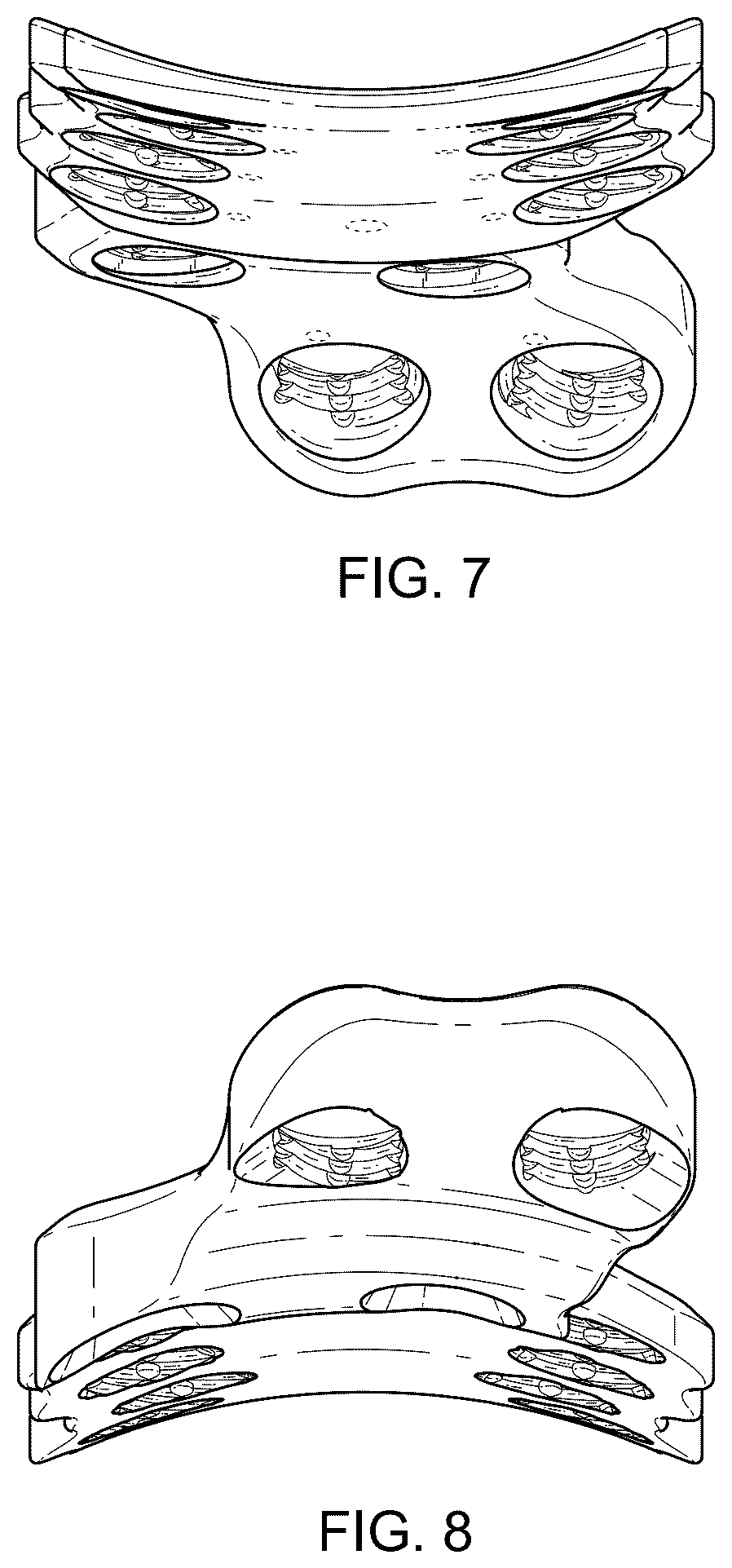 Patent USD1076090 Figure 7 – Straddle bone plate