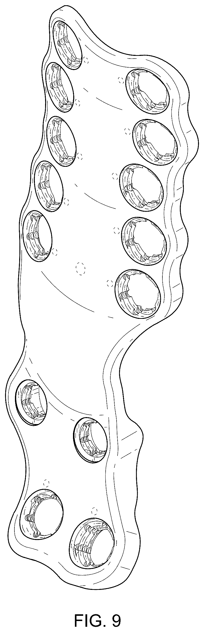 Patent USD1076090 Figure 8 – Straddle bone plate