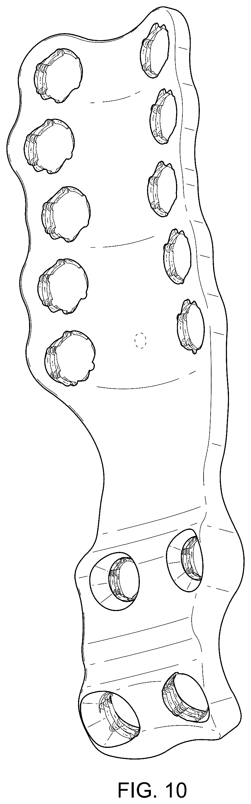 Patent USD1076090 Figure 9 – Straddle bone plate