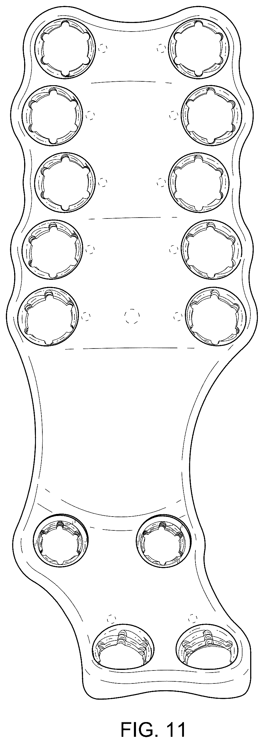 Patent USD1076090 Figure 10 – Straddle bone plate