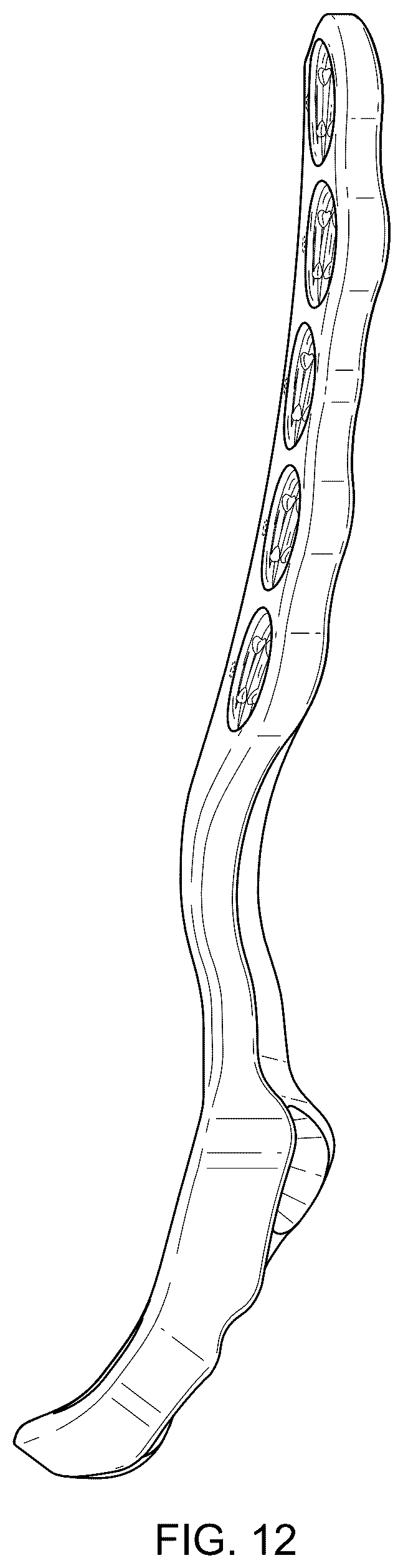 Patent USD1076090 Figure 11 – Straddle bone plate