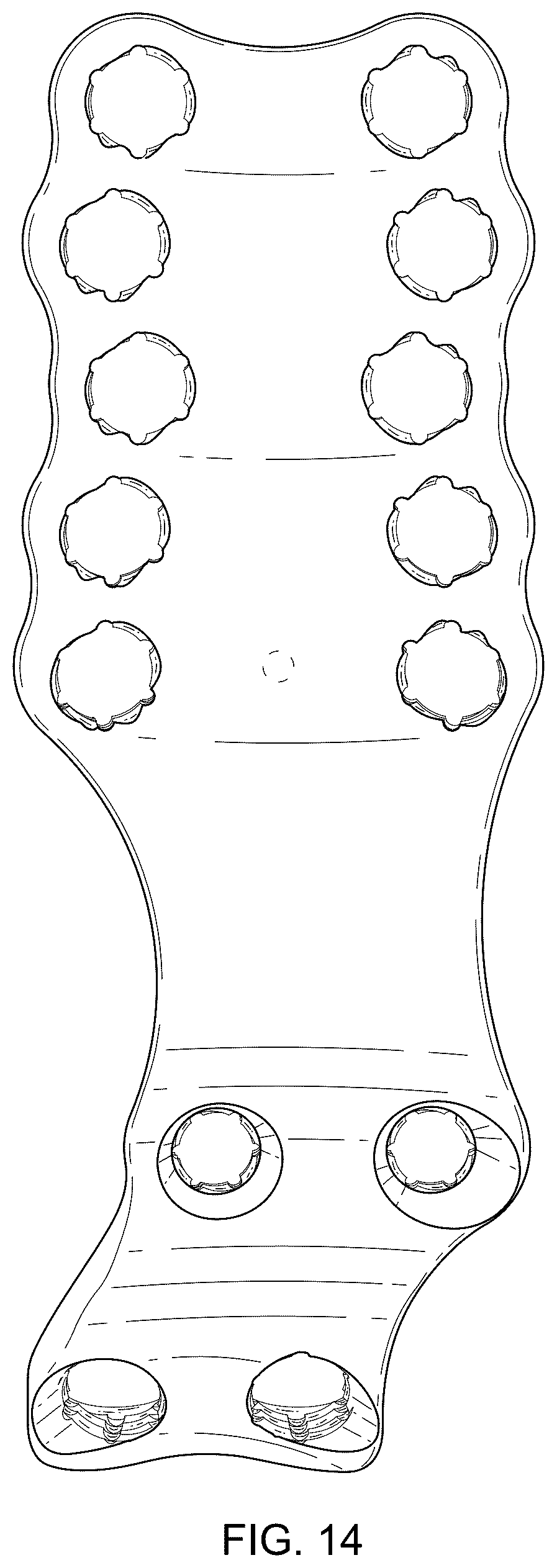 Patent USD1076090 Figure 13 – Straddle bone plate