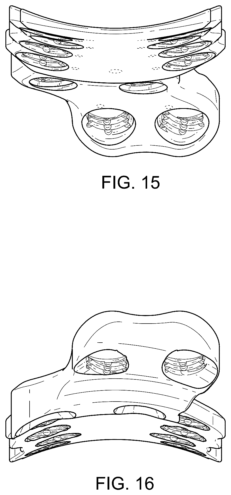 Patent USD1076090 Figure 14 – Straddle bone plate