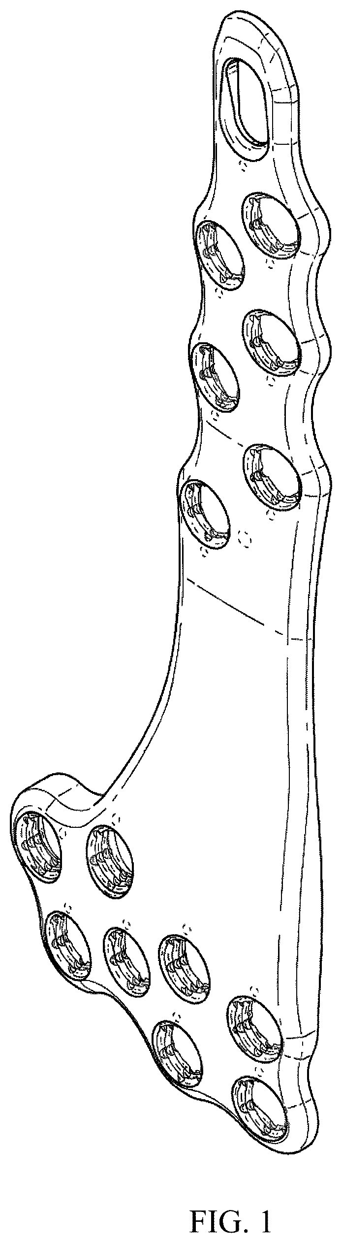 Patent USD1076091 Figure 1 – Straddle bone plate