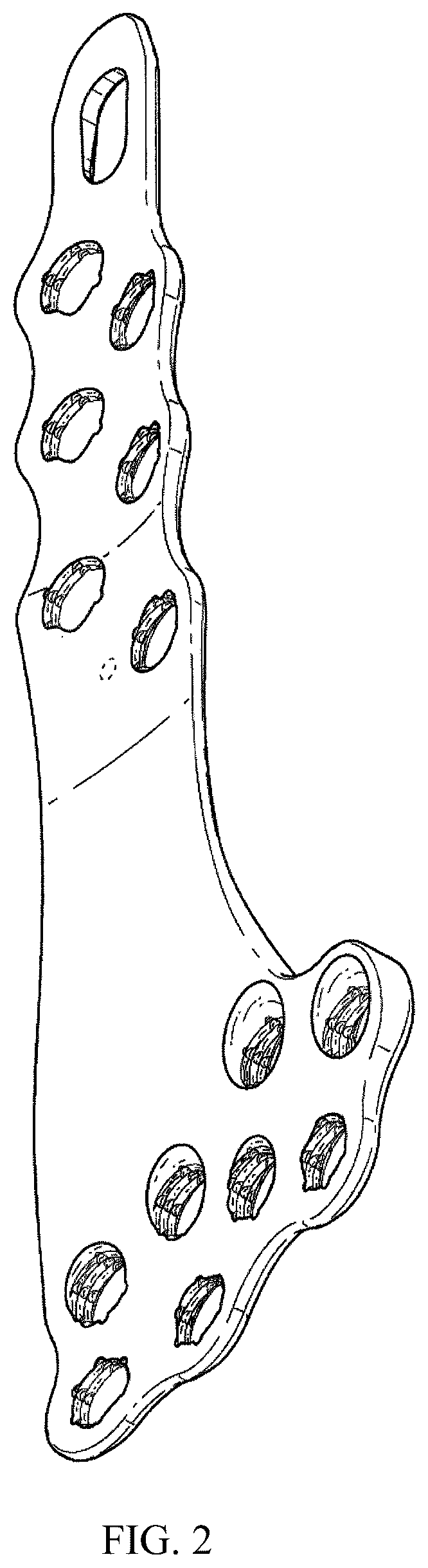 Patent USD1076091 Figure 2 – Straddle bone plate