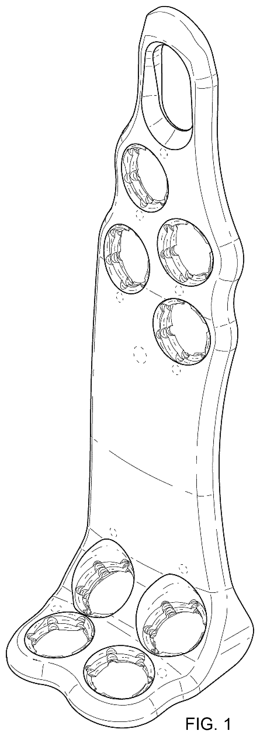 Patent USD1076092 Figure 1 – Span bone plate