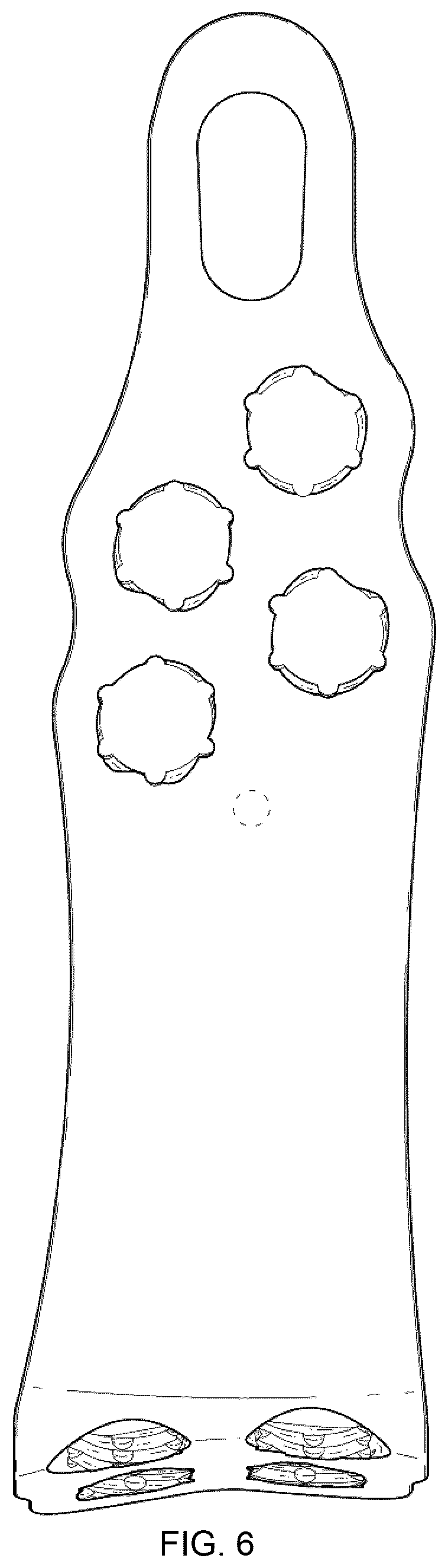 Patent USD1076092 Figure 5 – Span bone plate