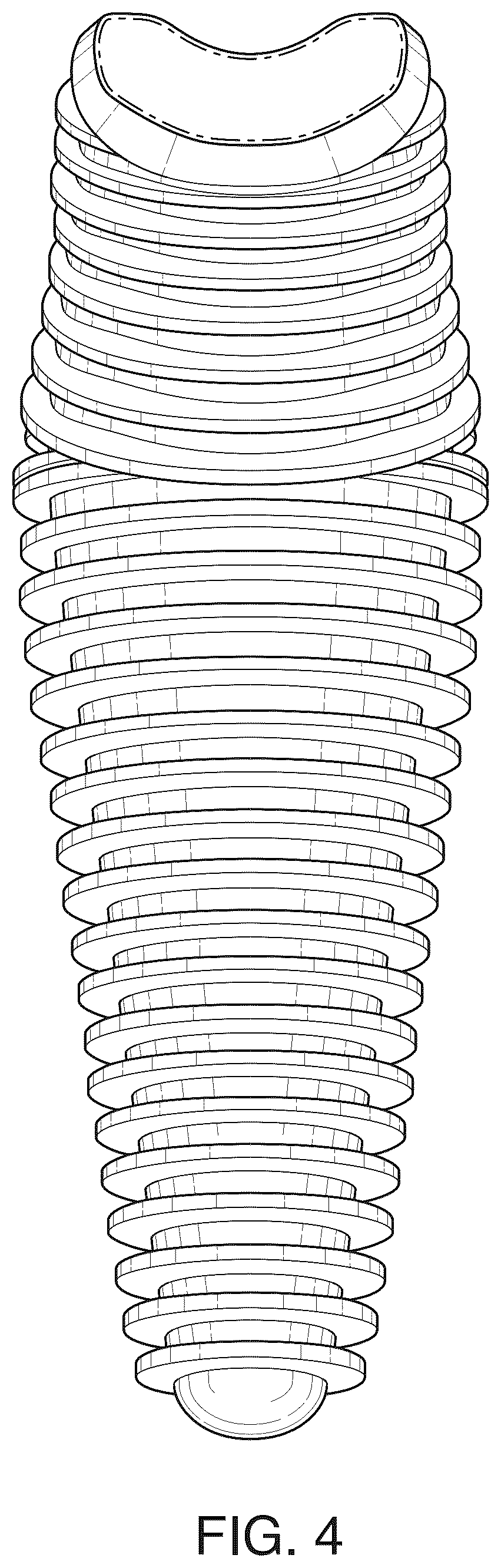 Patent USD1076094 Figure 4 – Implant