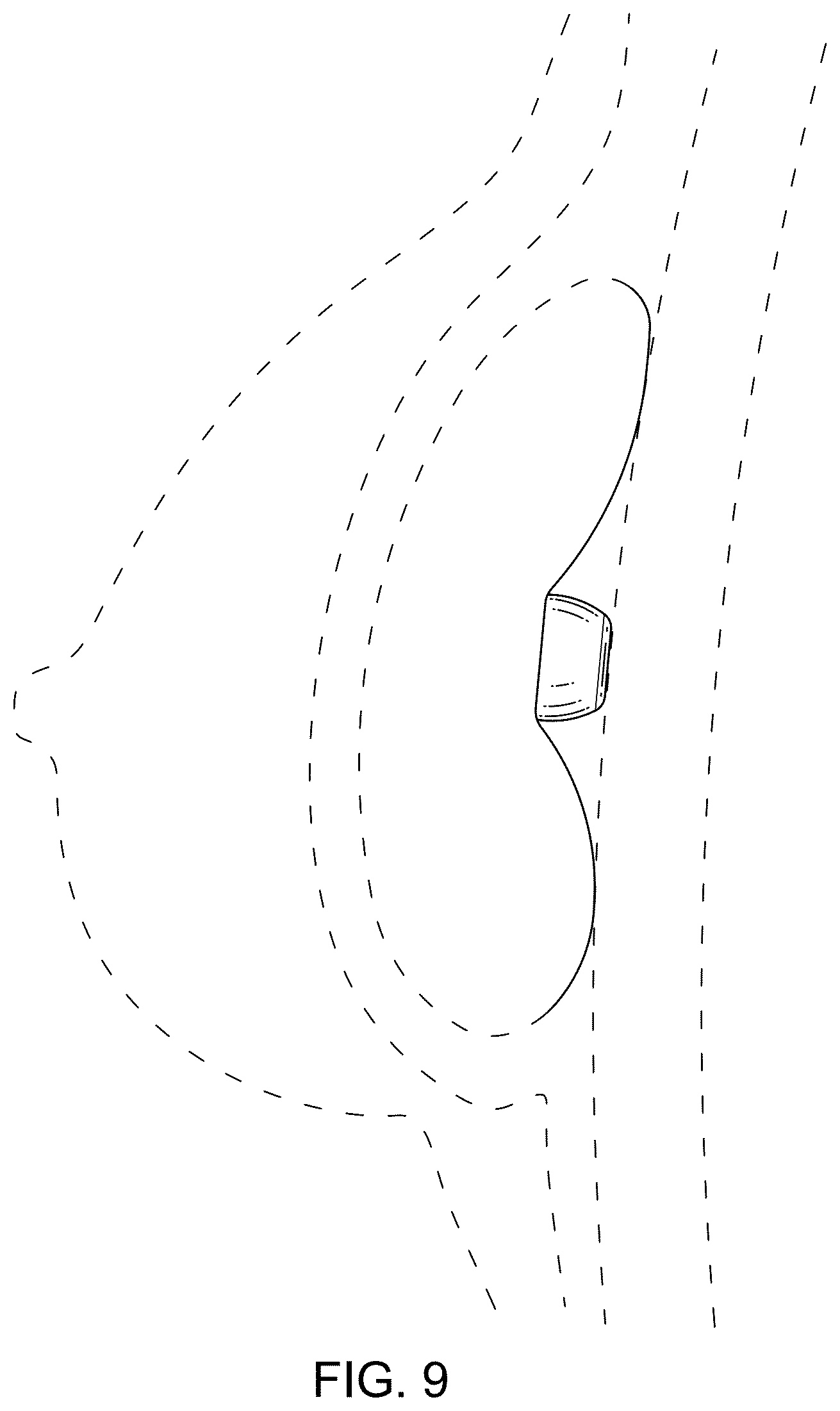 Patent USD1076095 Figure 9 – Breast implant enhancement device
