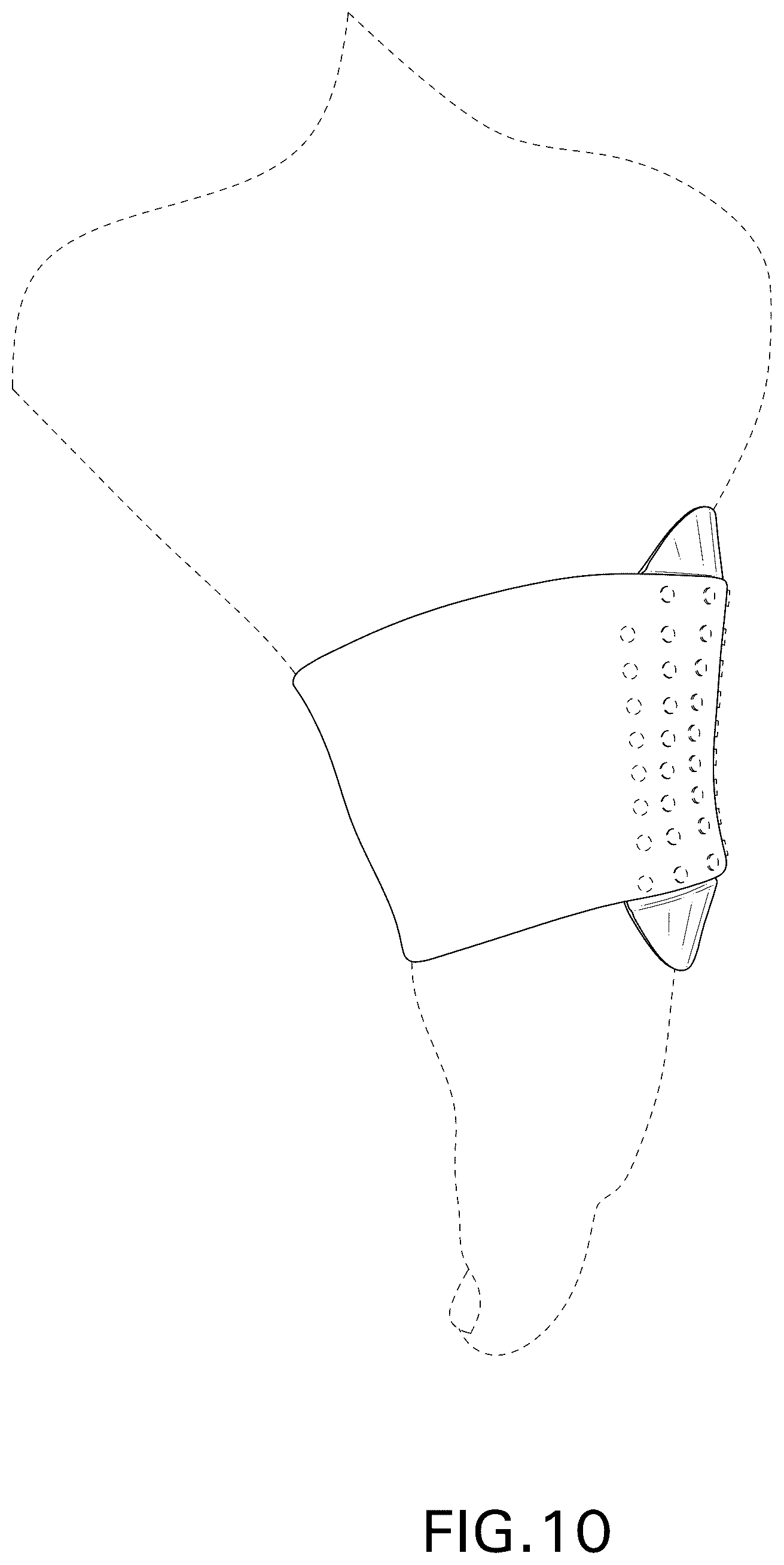 Patent USD1076115 Figure 9 – Arch support with sleeve