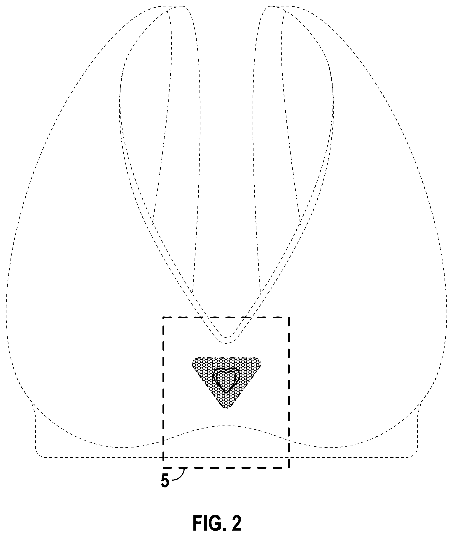 Patent USD1076327 Figure 2 – Bra including a lace pocket housing a heart-shaped crystal
