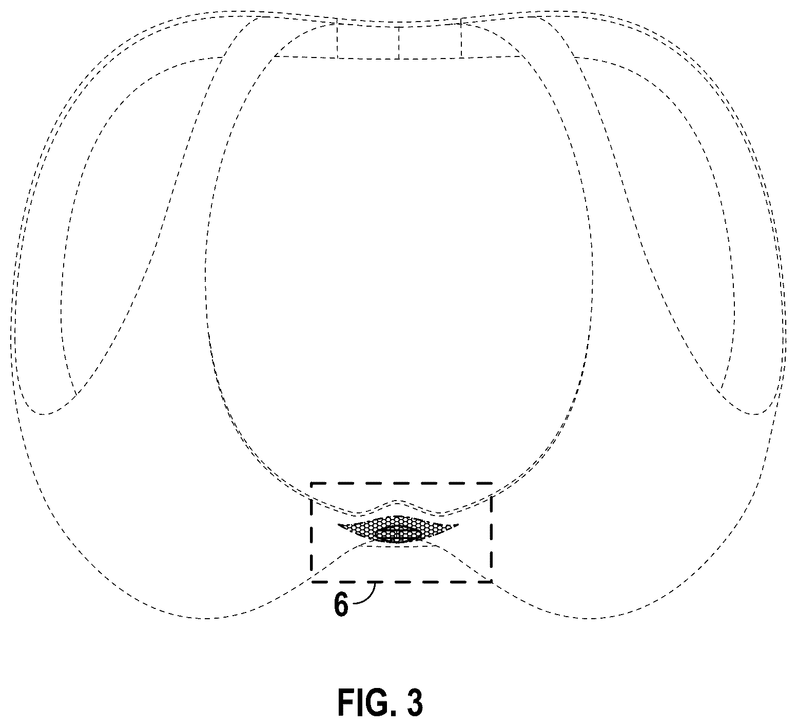 Patent USD1076327 Figure 3 – Bra including a lace pocket housing a heart-shaped crystal