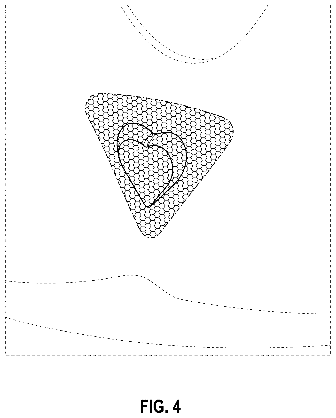 Patent USD1076327 Figure 4 – Bra including a lace pocket housing a heart-shaped crystal