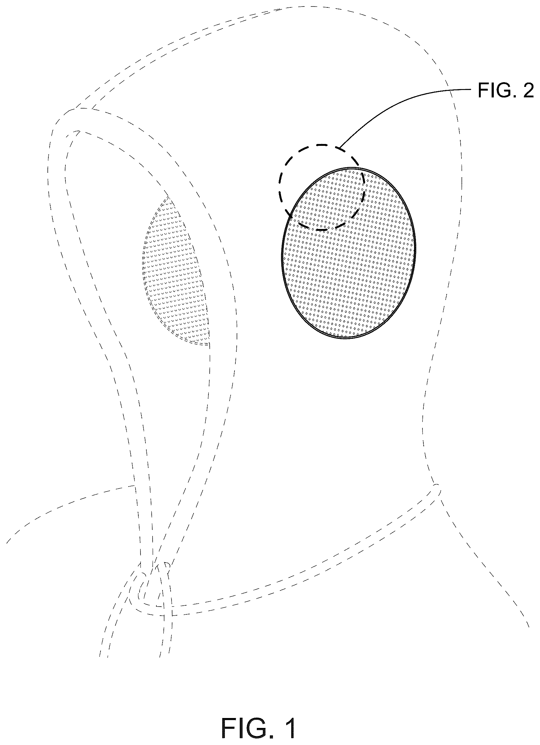 Patent USD1076340 Figure 1 – Hooded sweatshirt