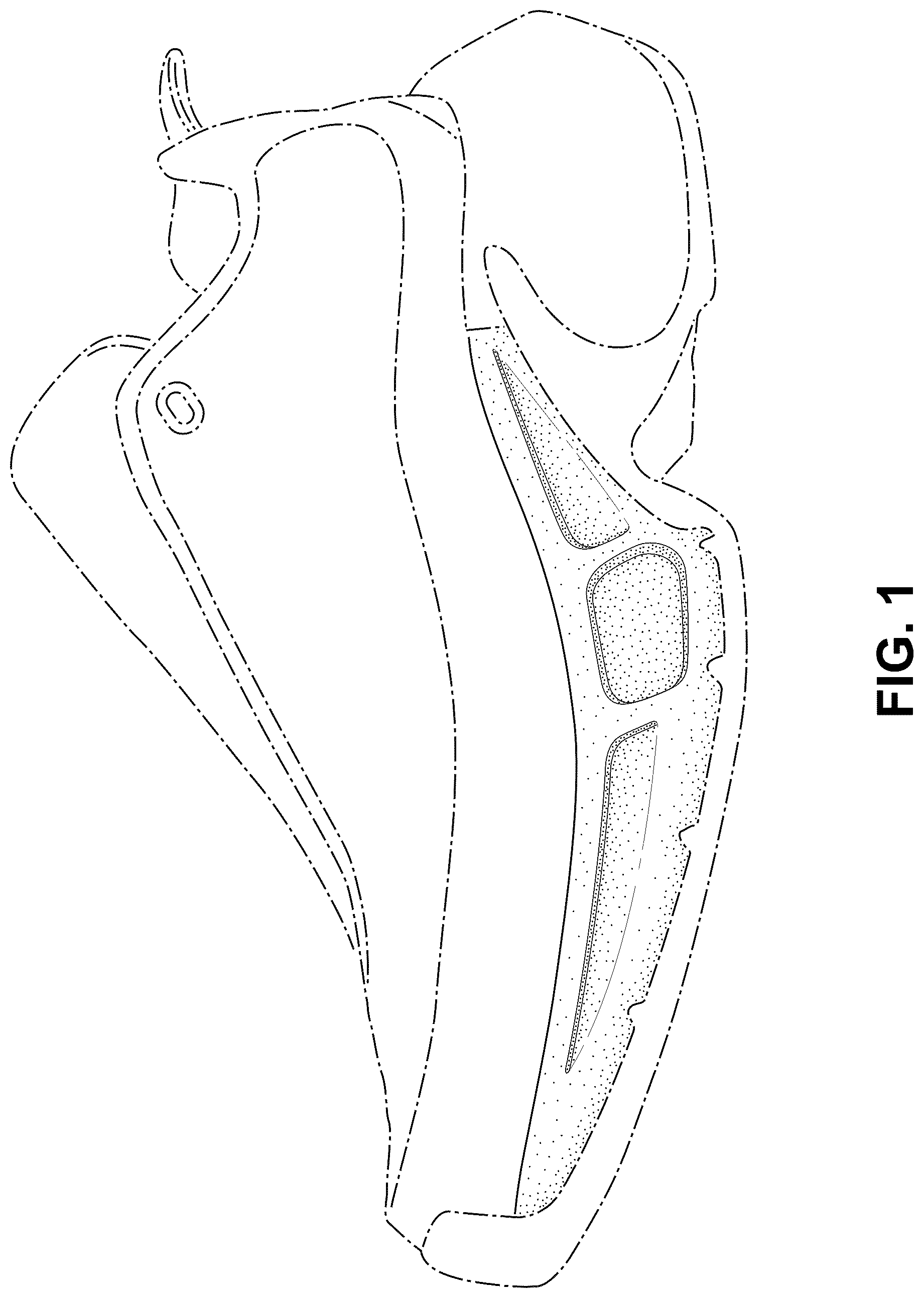 Patent USD1076368 Figure 1 – Shoe