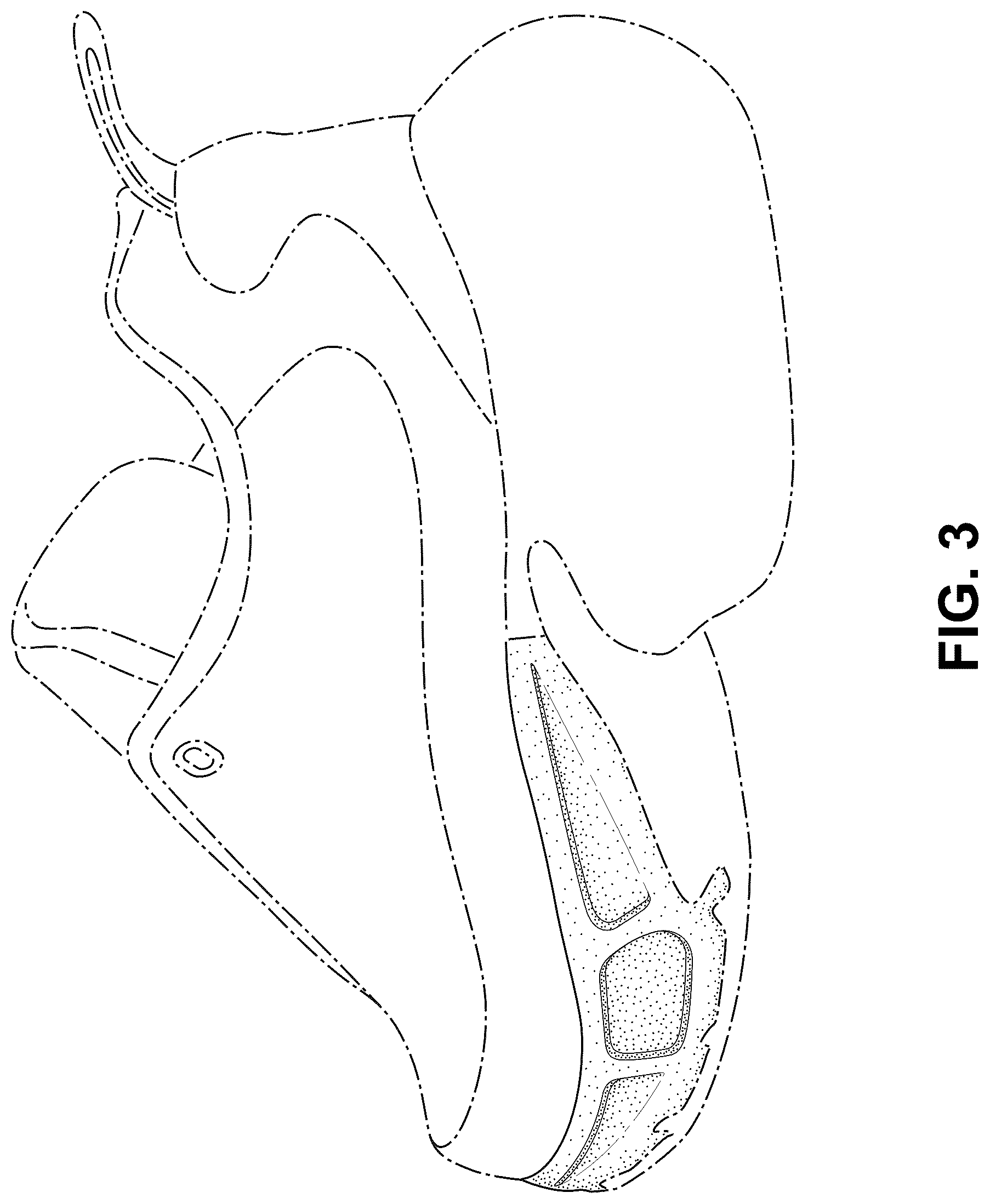 Patent USD1076368 Figure 3 – Shoe