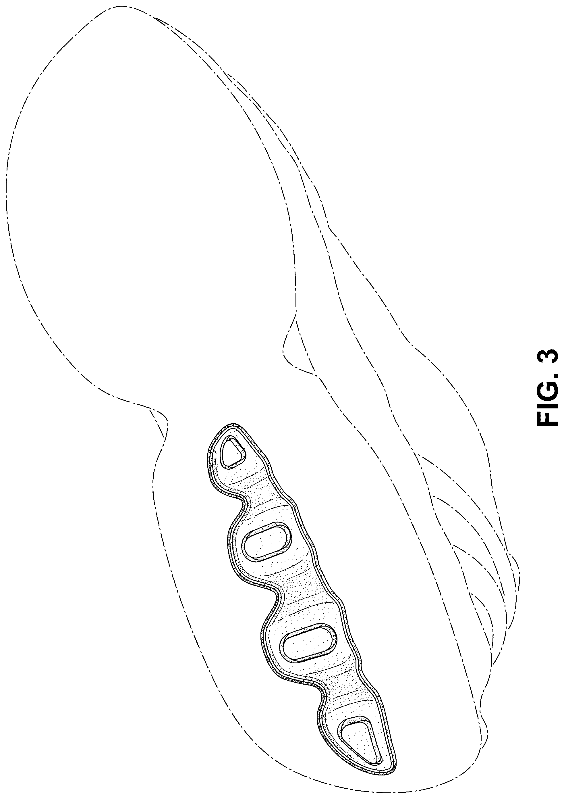 Patent USD1076371 Figure 3 – Shoe