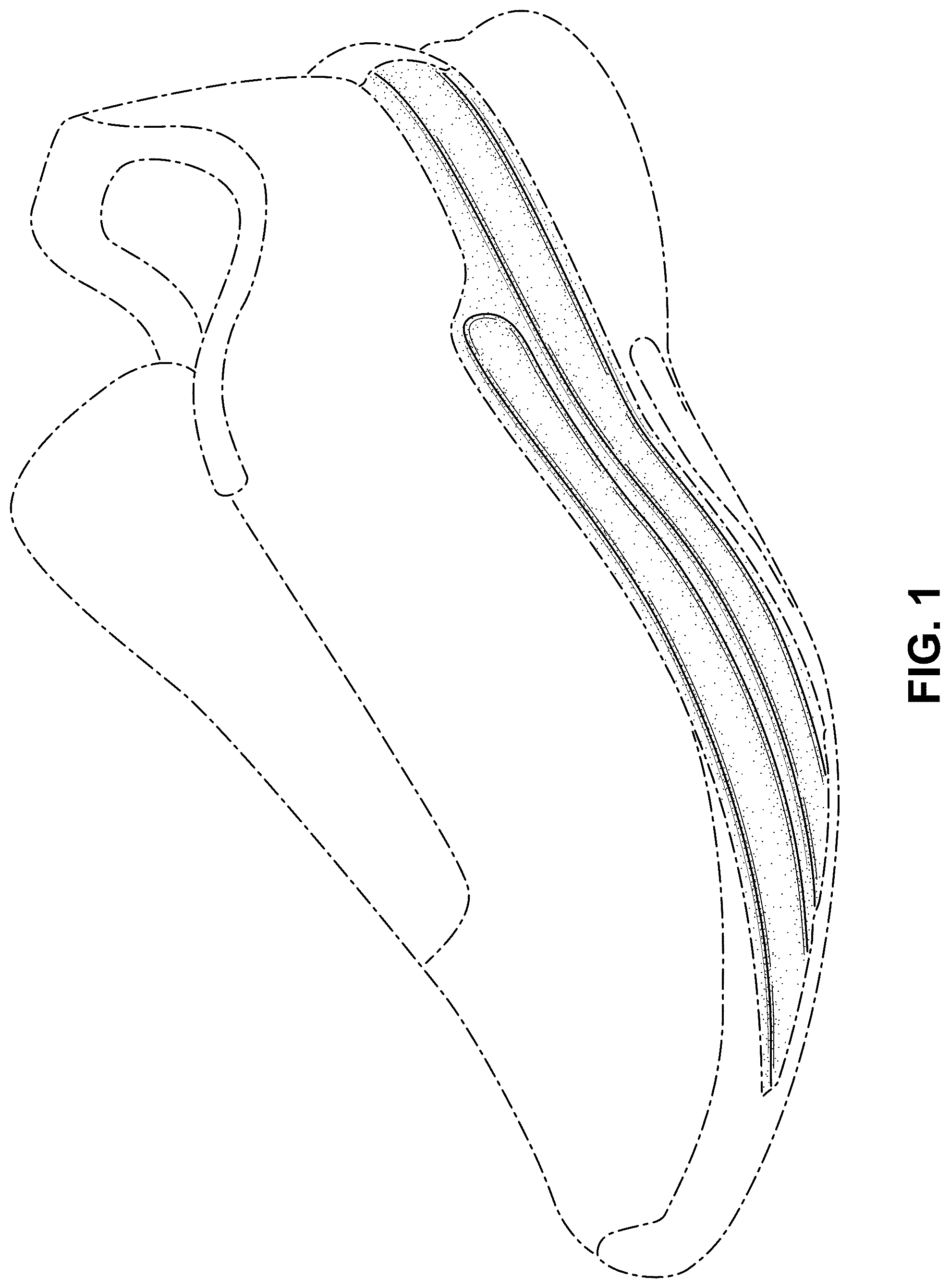 Patent USD1076373 Figure 1 – Shoe
