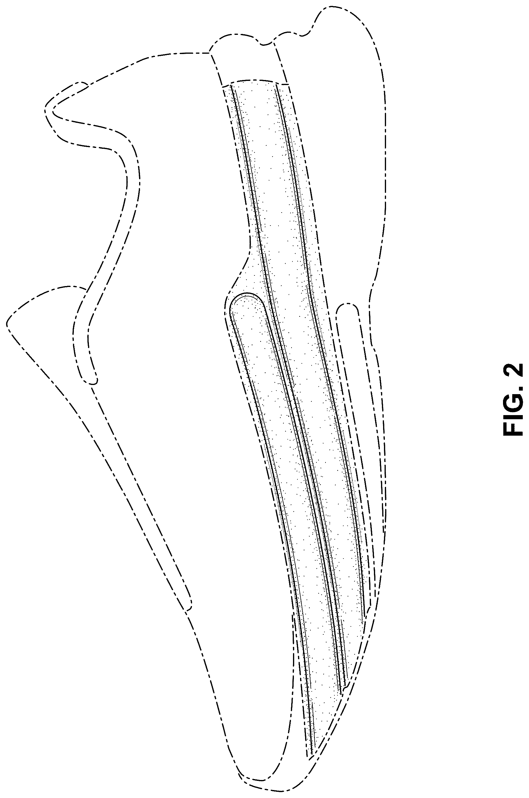 Patent USD1076373 Figure 2 – Shoe