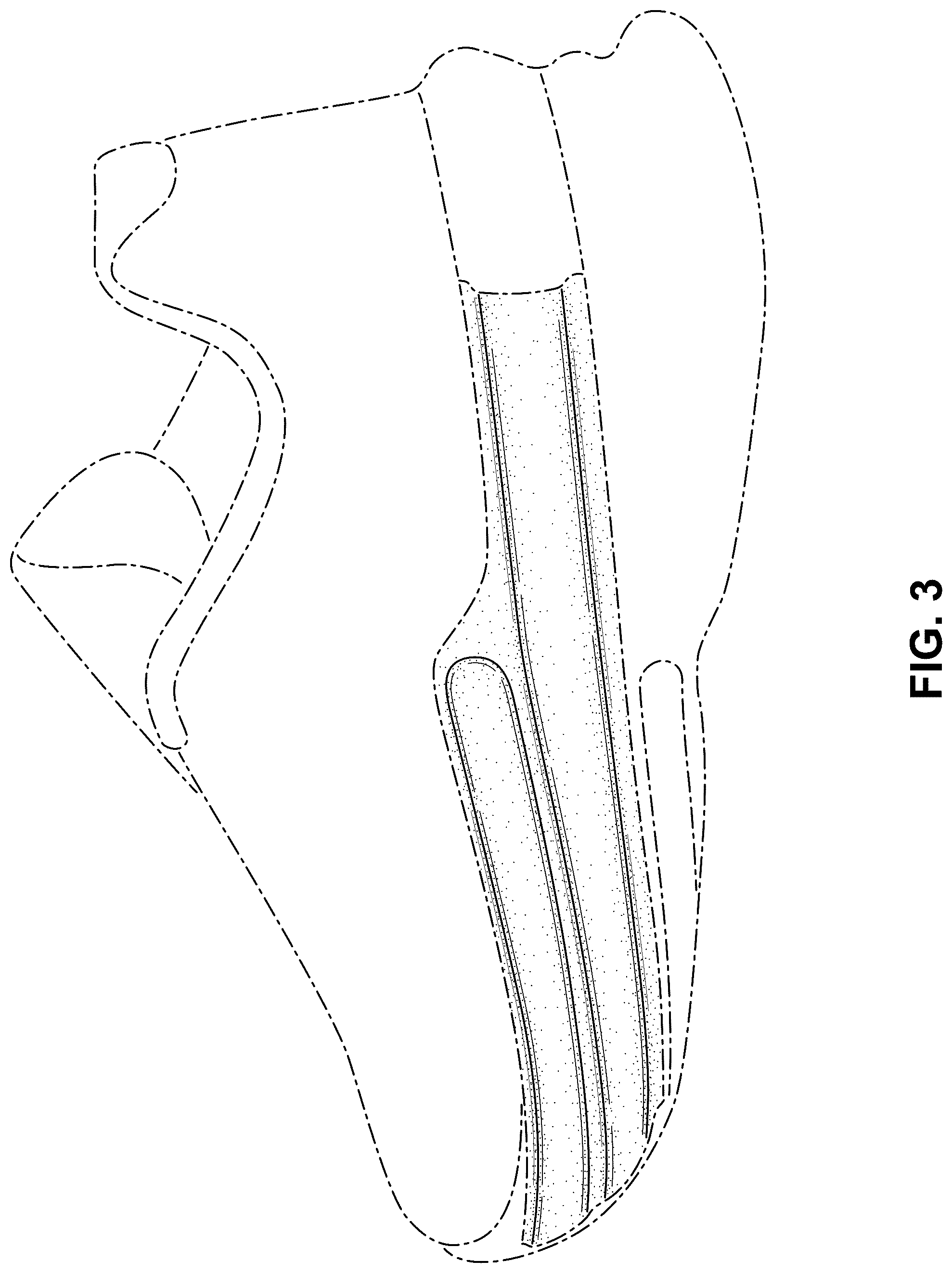 Patent USD1076373 Figure 3 – Shoe