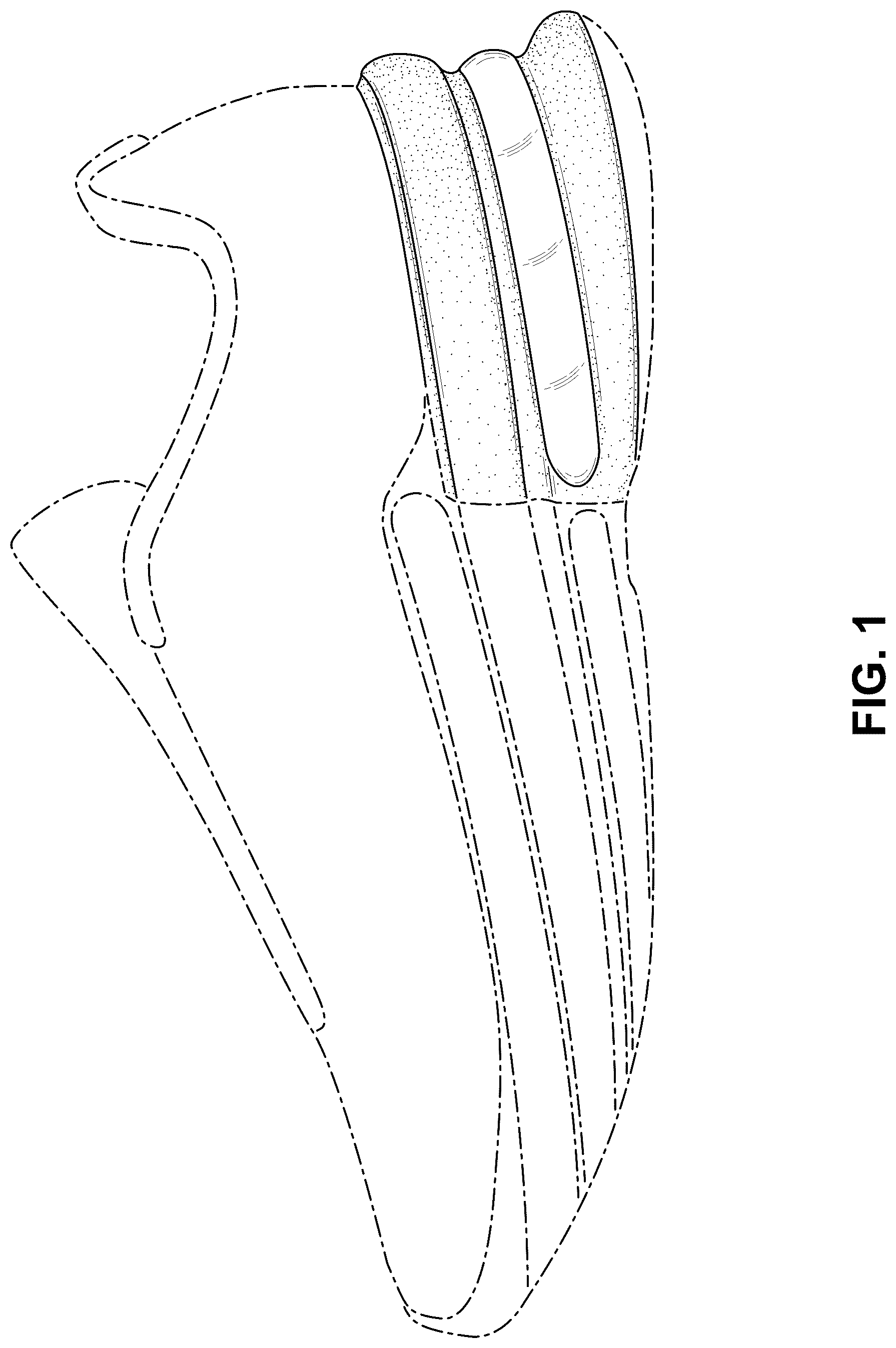 Patent USD1076374 Figure 1 – Shoe