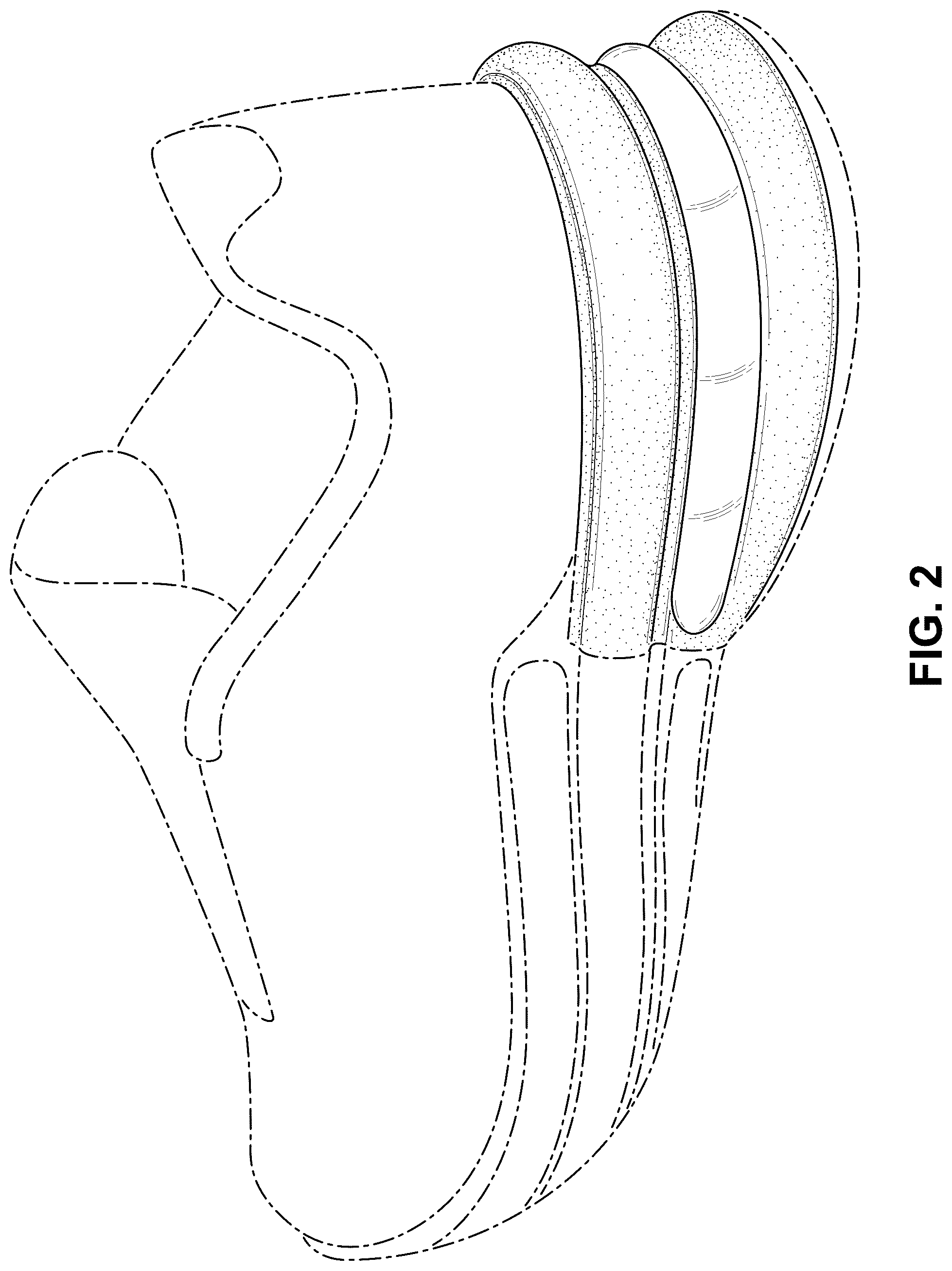 Patent USD1076374 Figure 2 – Shoe