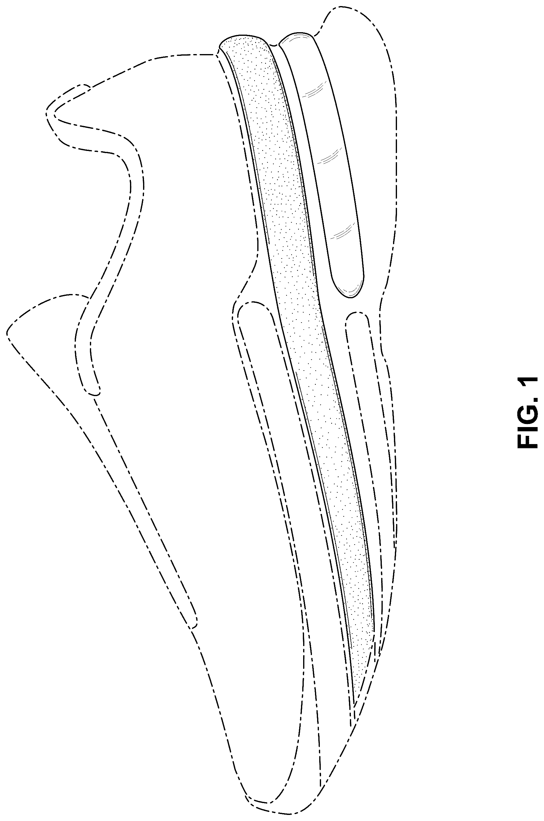 Patent USD1076375 Figure 1 – Shoe
