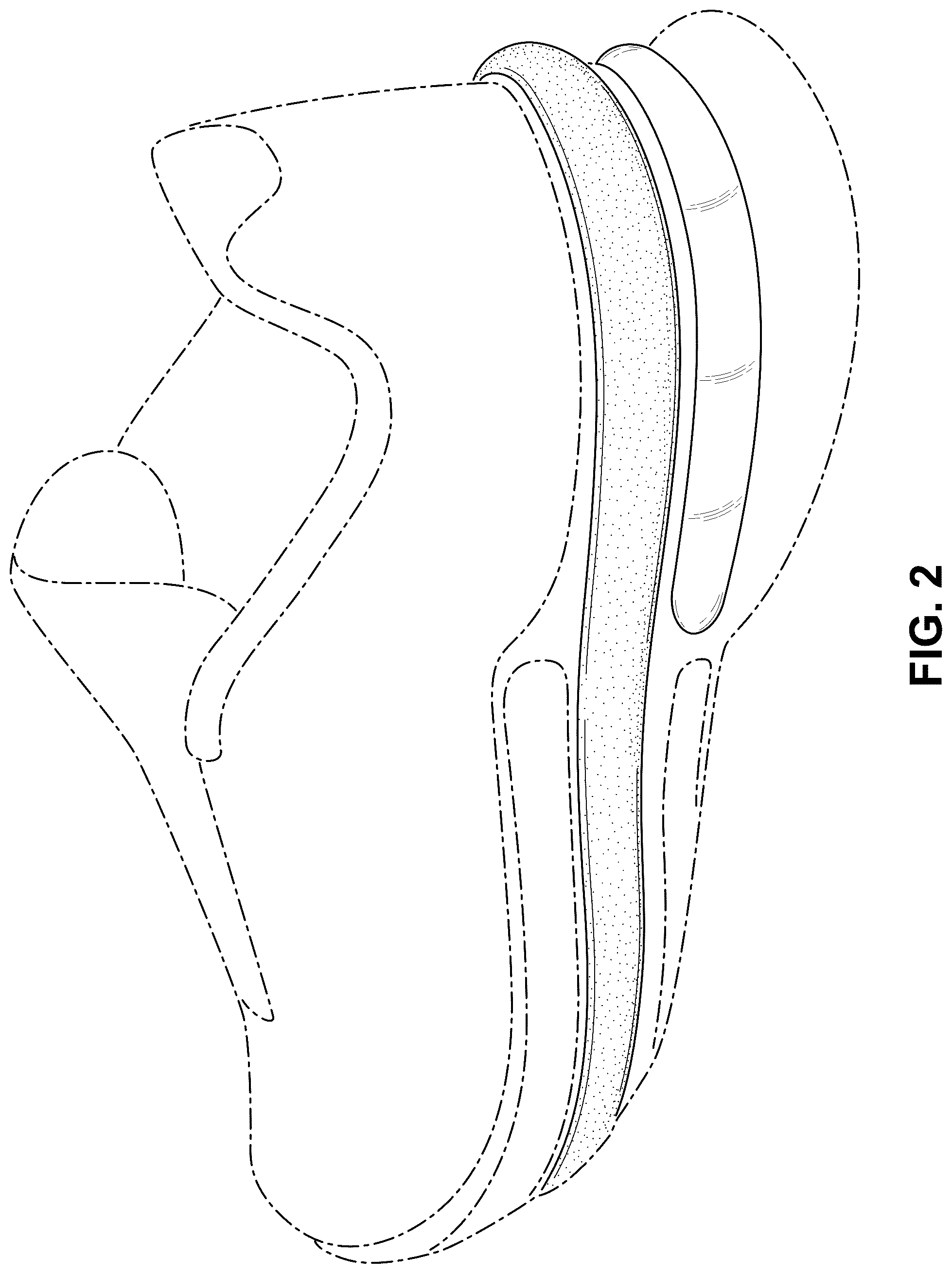 Patent USD1076375 Figure 2 – Shoe
