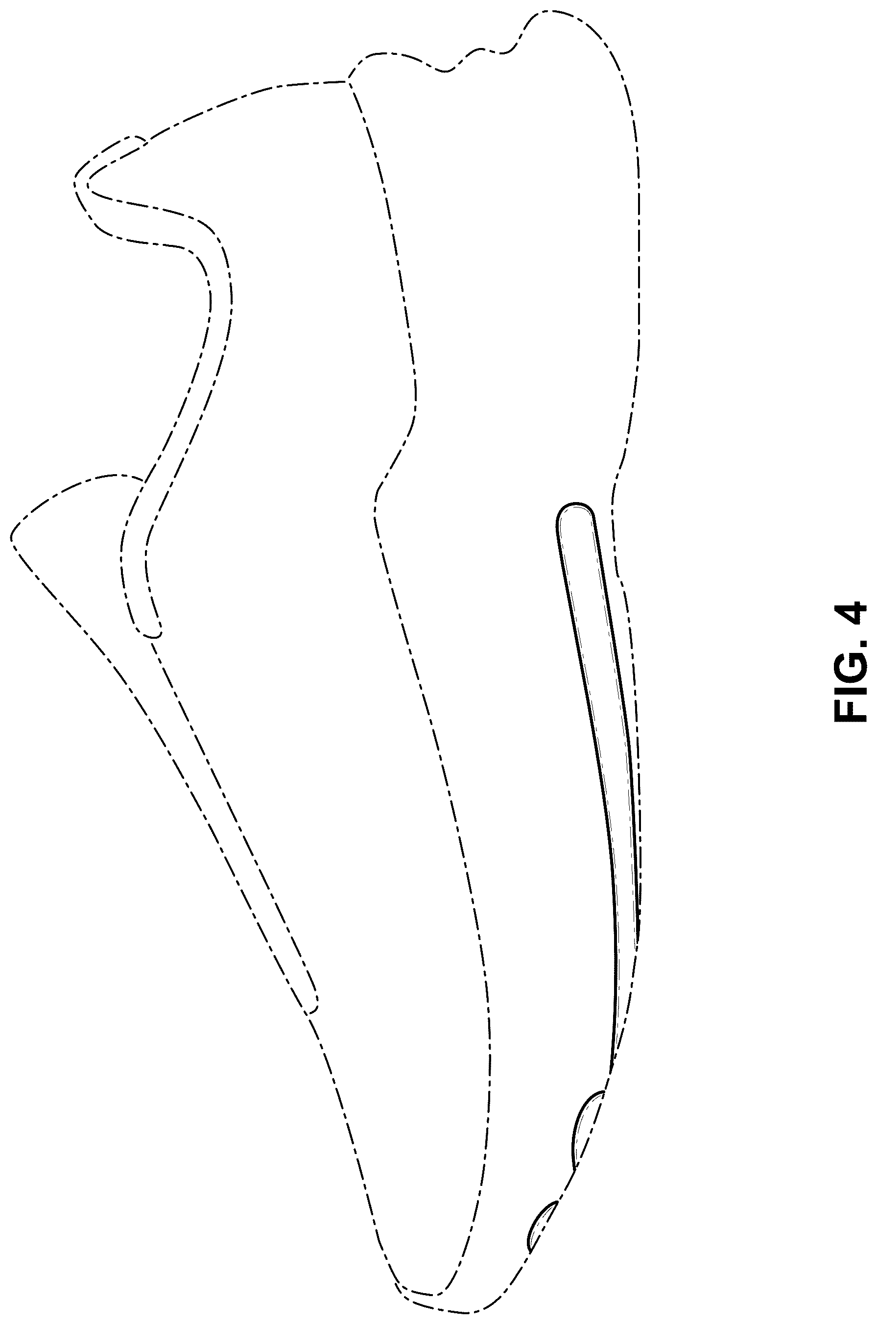 Patent USD1076376 Figure 4 – Shoe