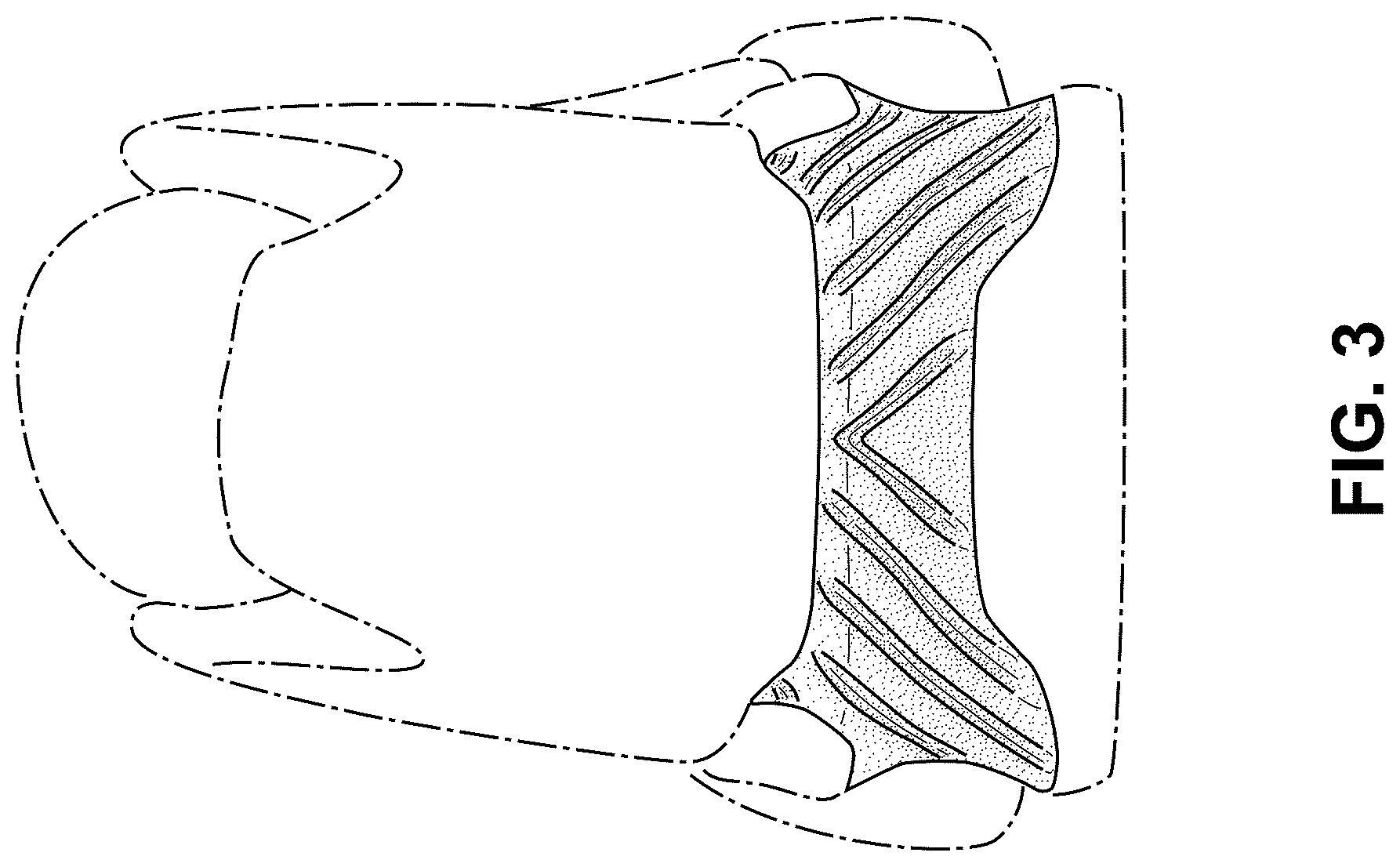 Patent USD1076378 Figure 3 – Shoe