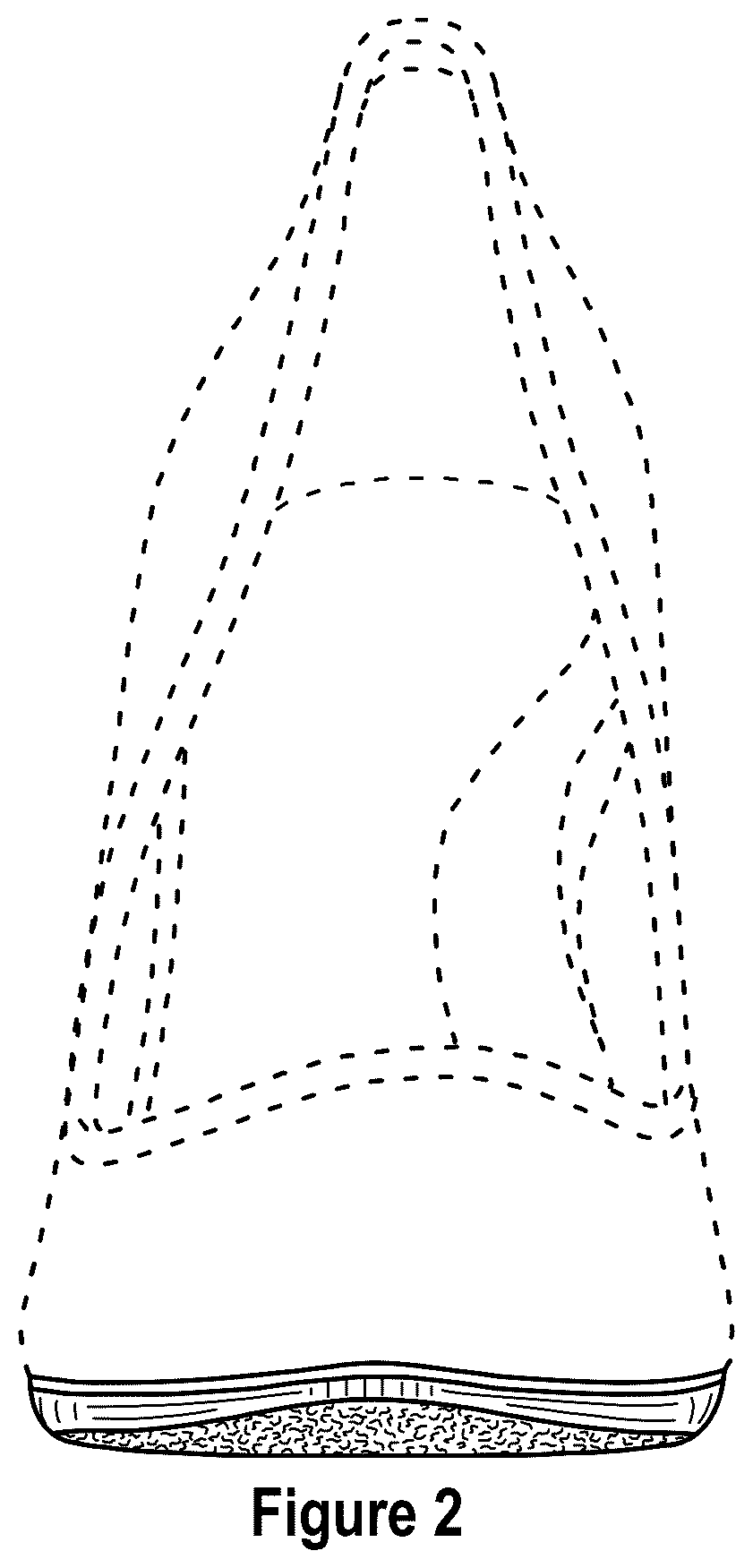Patent USD1076379 Figure 2 – Pointed toe shoe with heel and outsole patch