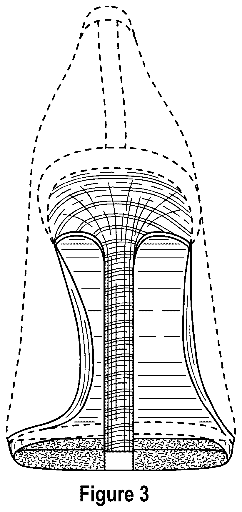 Patent USD1076379 Figure 3 – Pointed toe shoe with heel and outsole patch