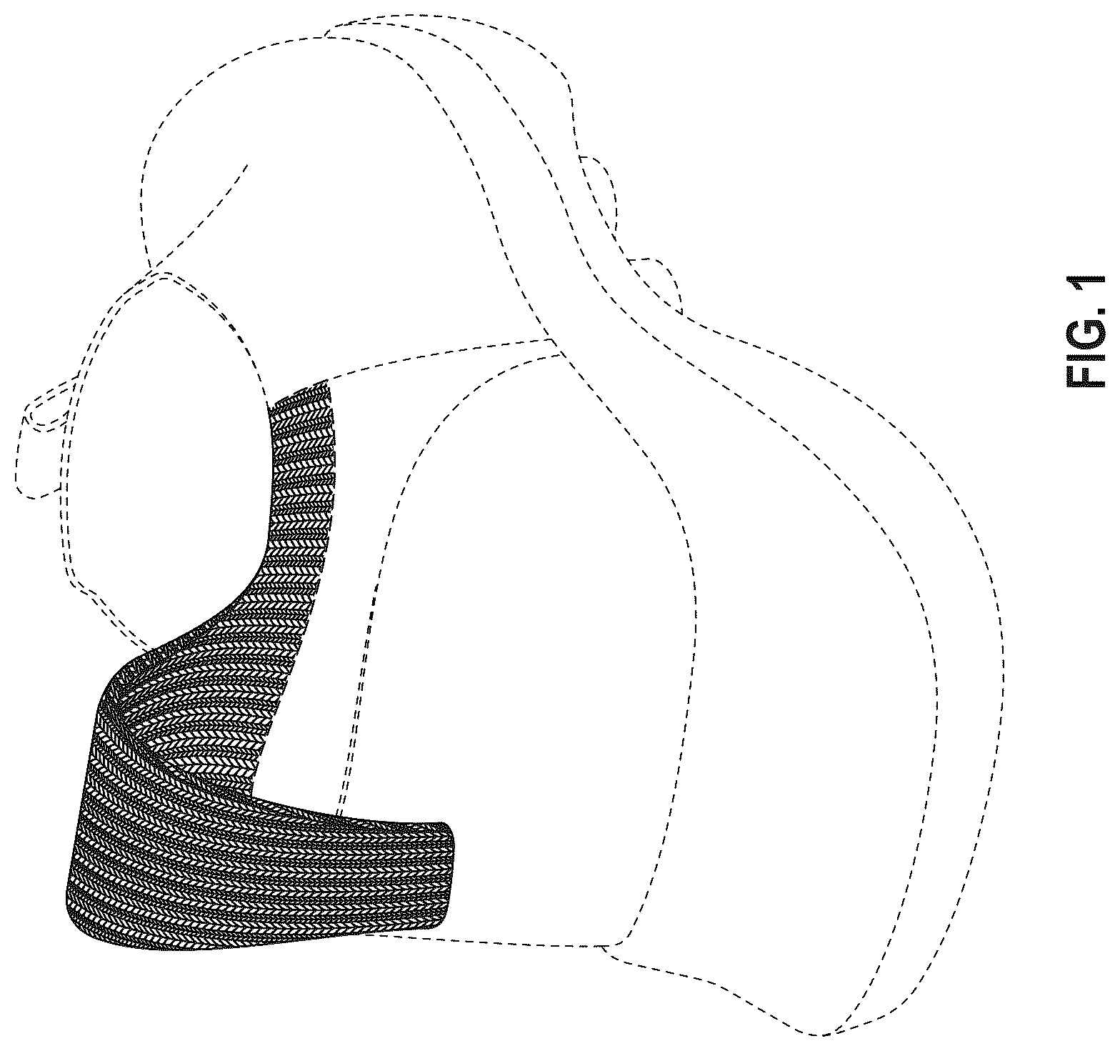 Patent USD1076393 Figure 1 – Shoe upper