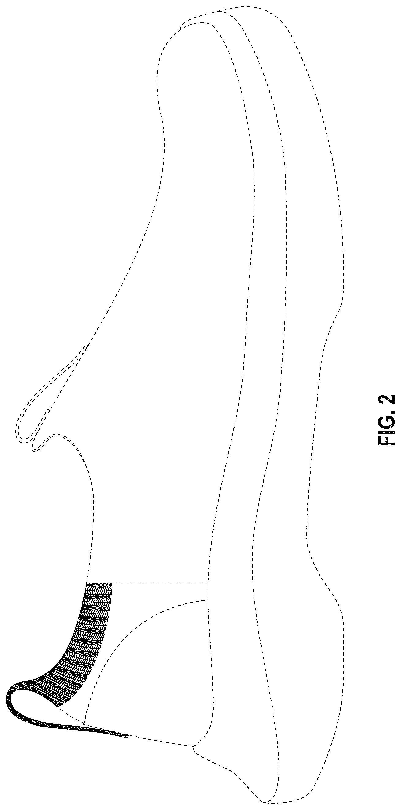Patent USD1076393 Figure 2 – Shoe upper