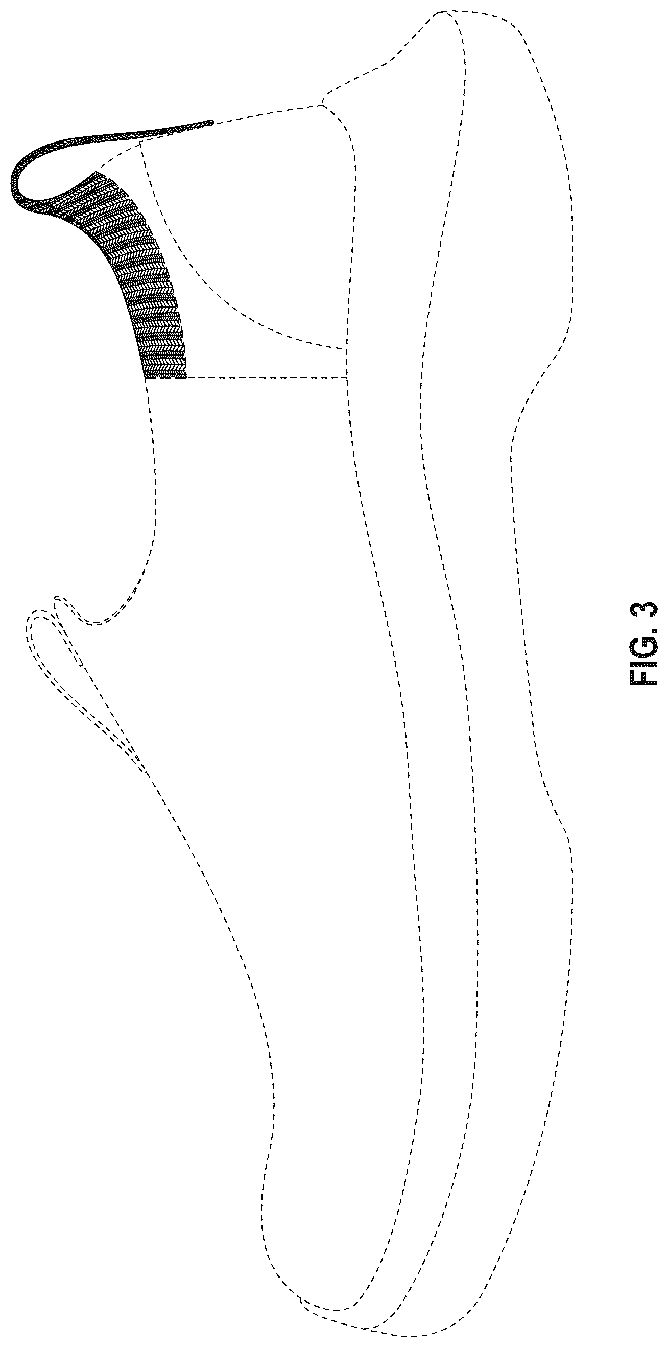 Patent USD1076393 Figure 3 – Shoe upper