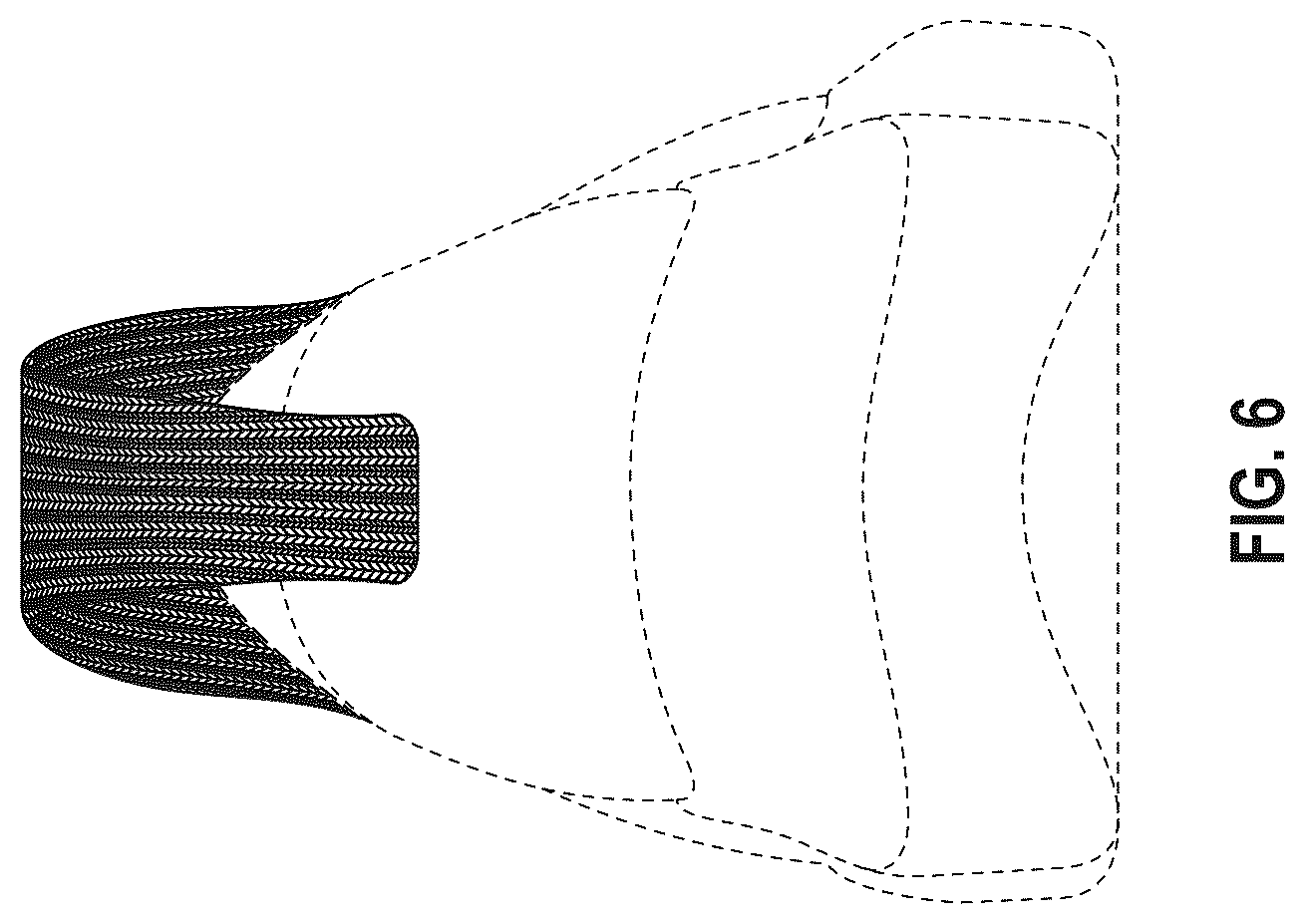 Patent USD1076393 Figure 6 – Shoe upper