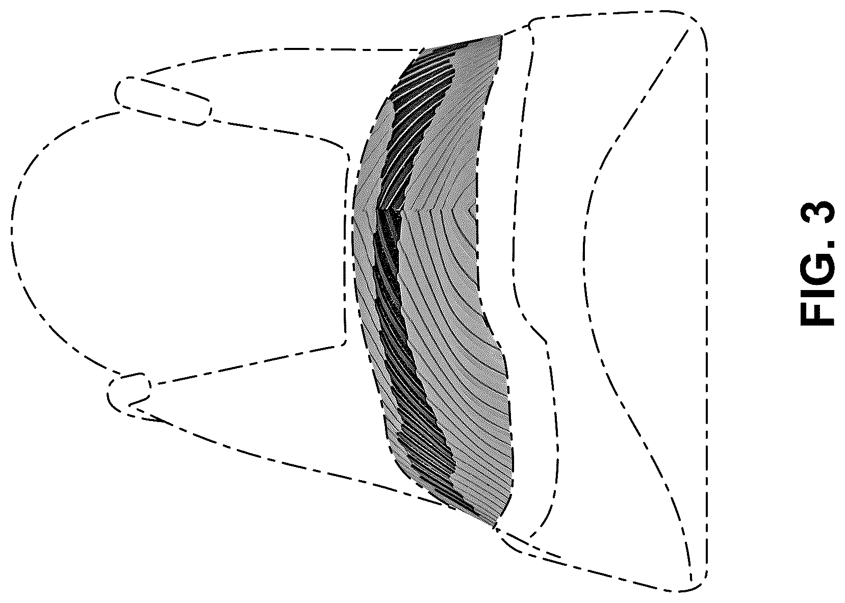Patent USD1076397 Figure 3 – Shoe