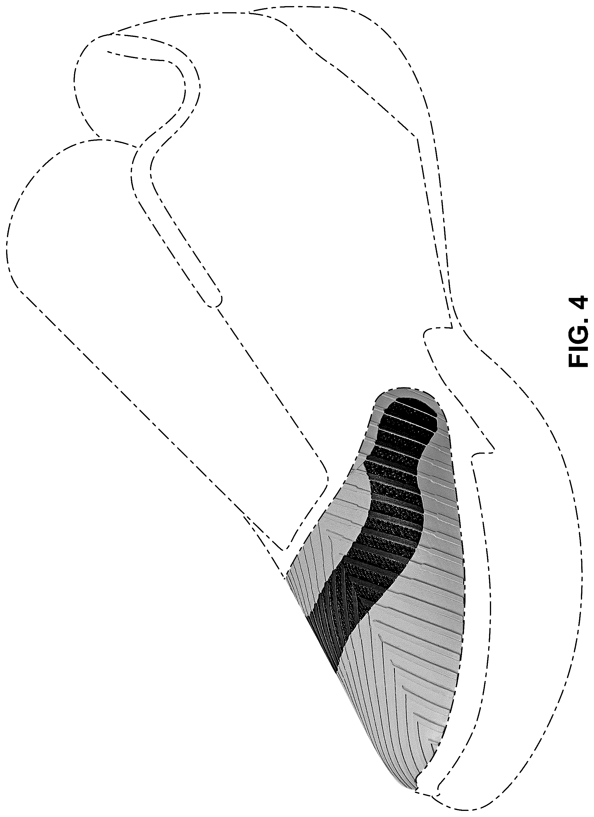 Patent USD1076397 Figure 4 – Shoe