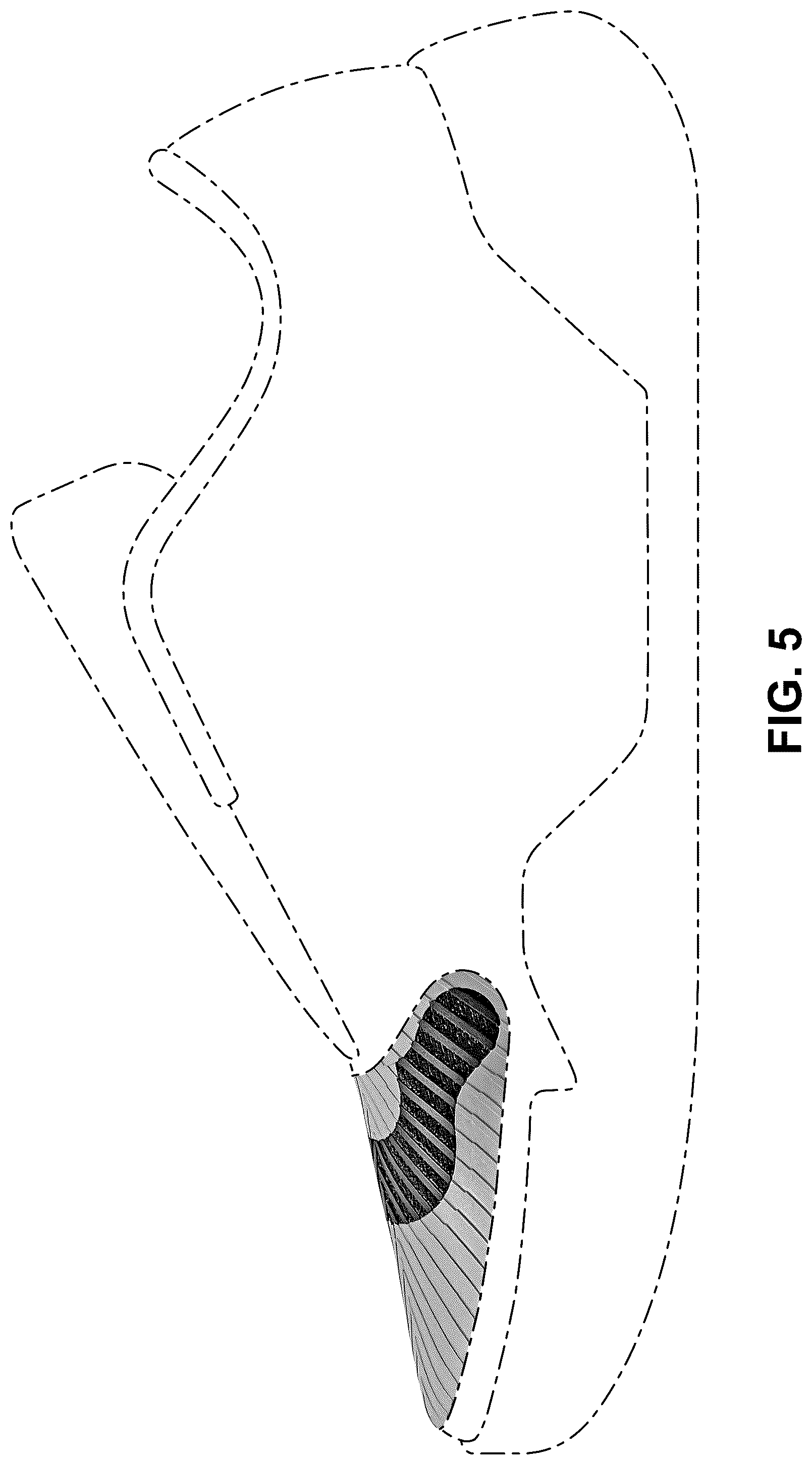 Patent USD1076397 Figure 5 – Shoe