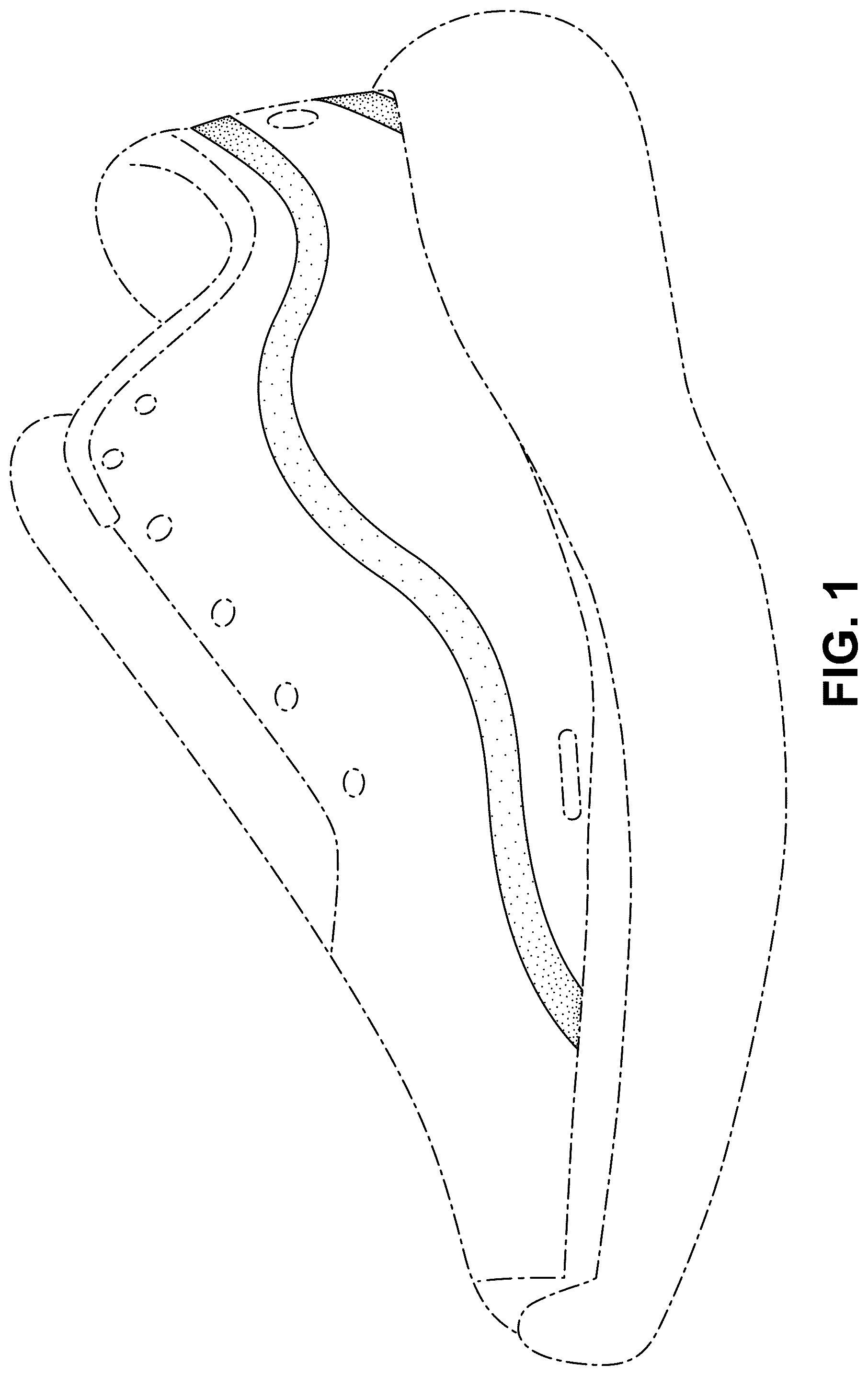 Patent USD1076398 Figure 1 – Shoe