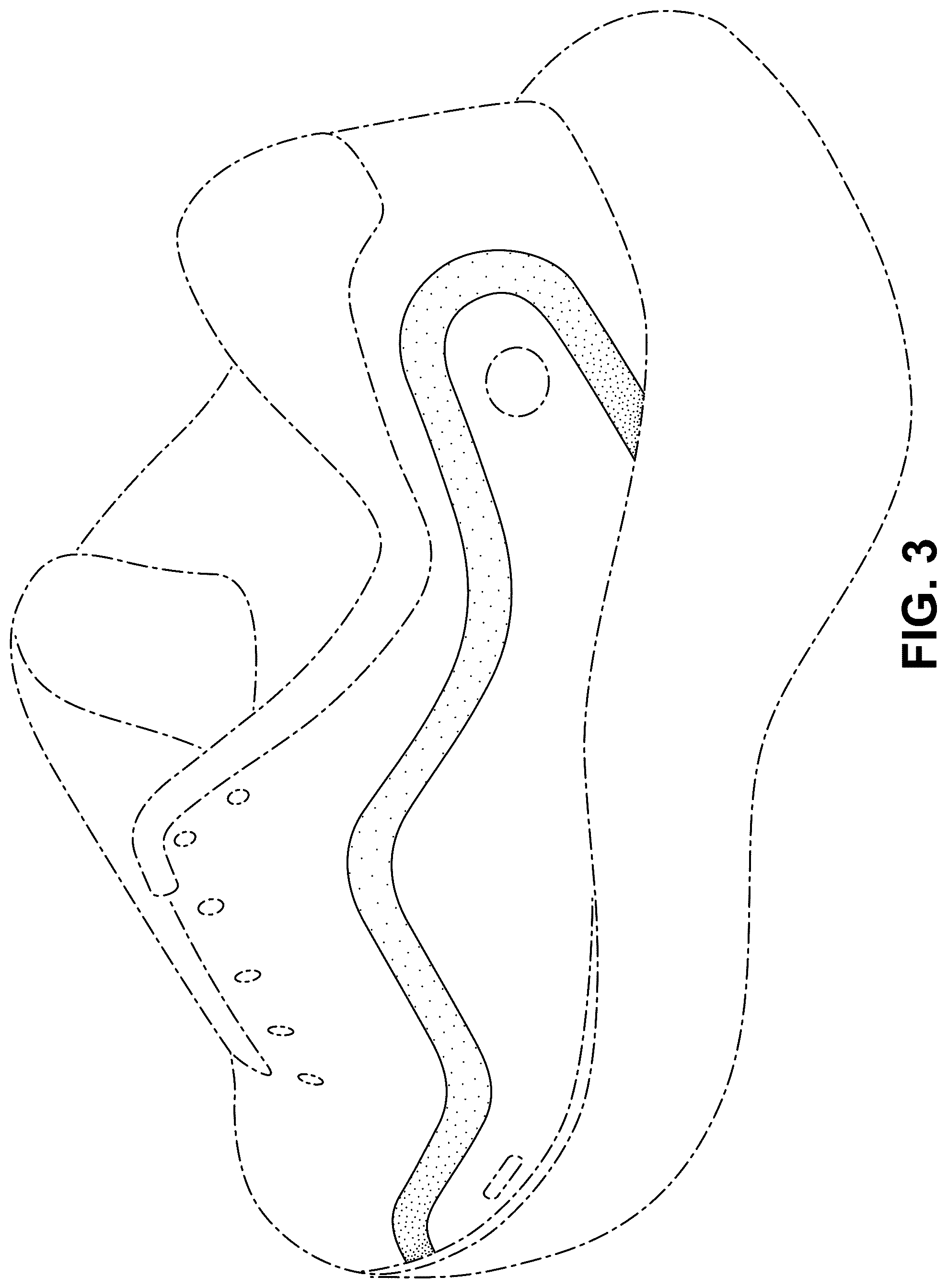Patent USD1076398 Figure 3 – Shoe