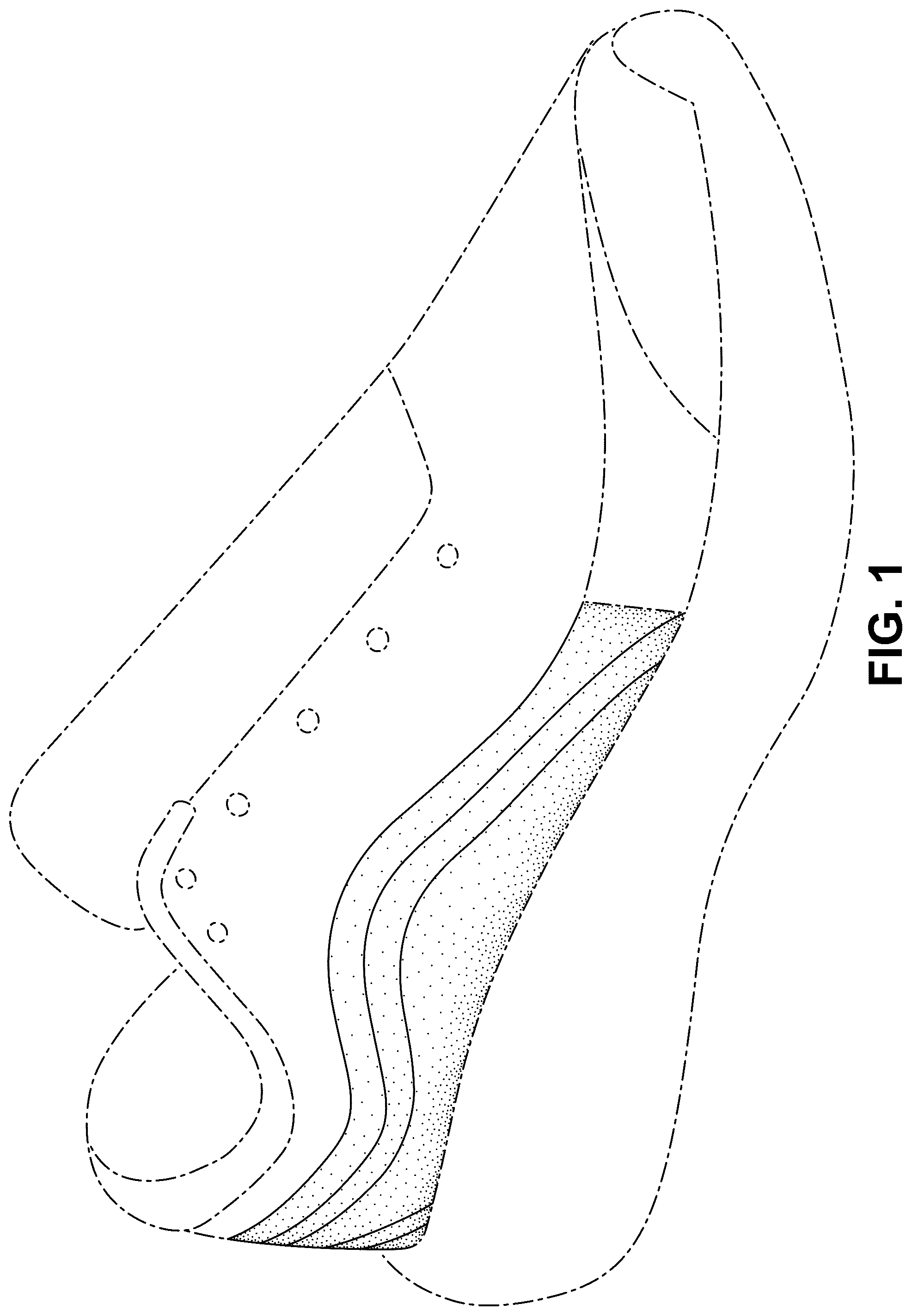 Patent USD1076399 Figure 1 – Shoe