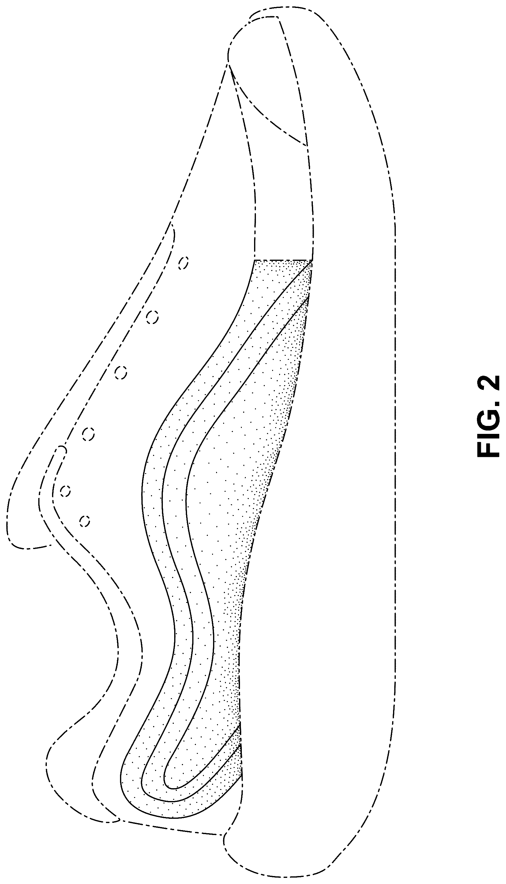 Patent USD1076399 Figure 2 – Shoe