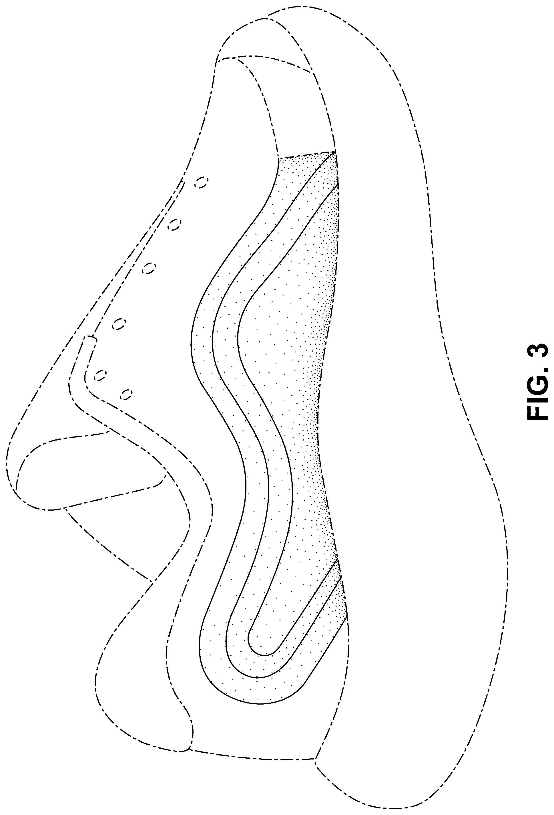Patent USD1076399 Figure 3 – Shoe