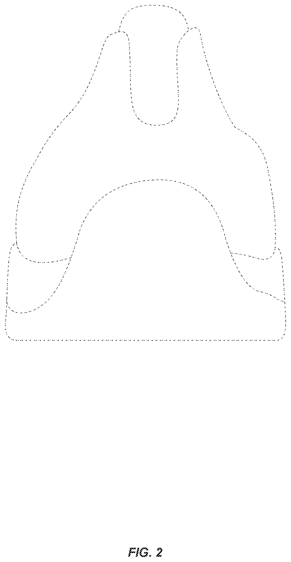 Patent USD1076400 Figure 2 – Shoe upper