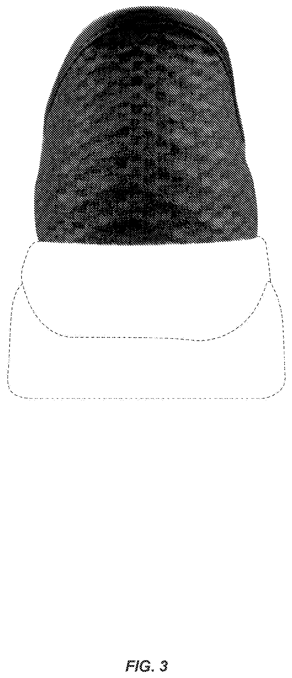 Patent USD1076400 Figure 3 – Shoe upper