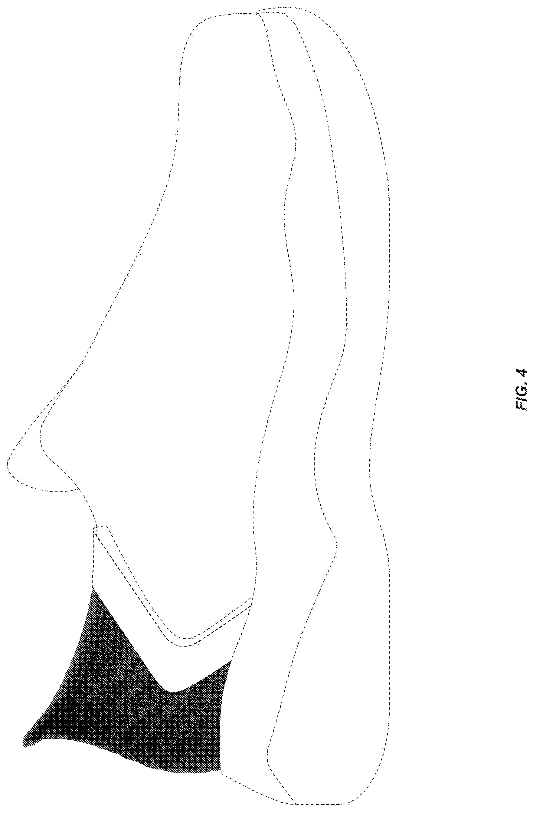 Patent USD1076400 Figure 4 – Shoe upper