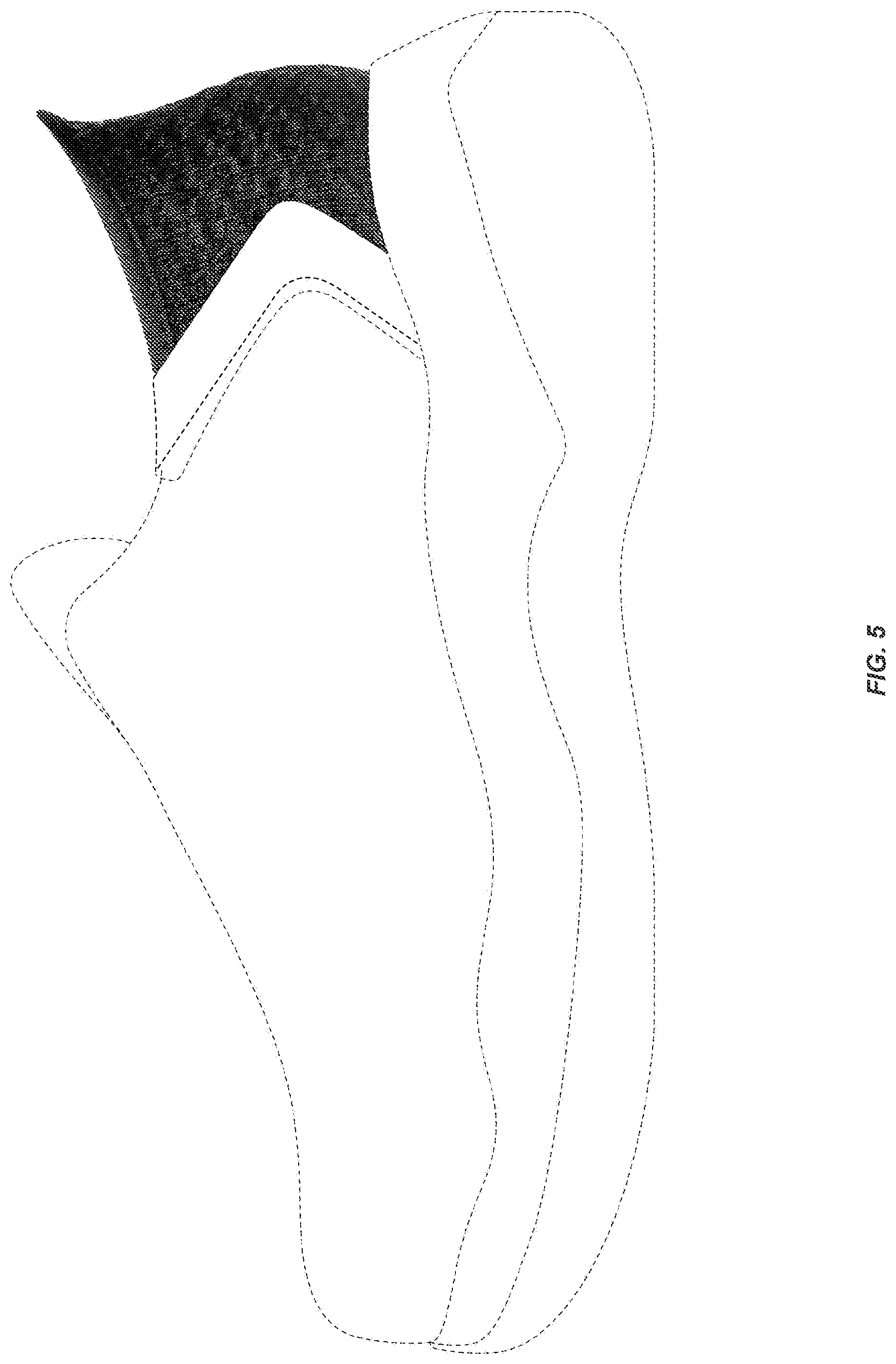 Patent USD1076400 Figure 5 – Shoe upper