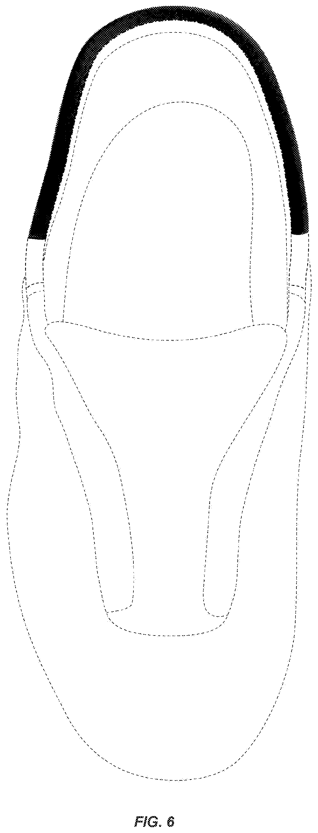 Patent USD1076400 Figure 6 – Shoe upper