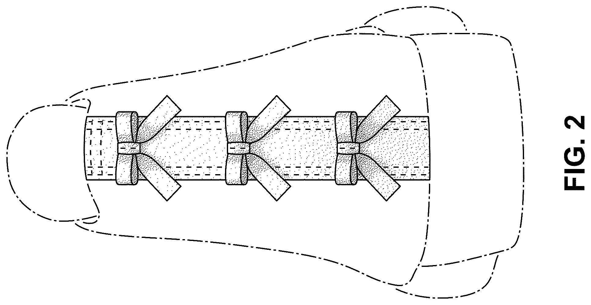 Patent USD1077424 Figure 2 – Shoe